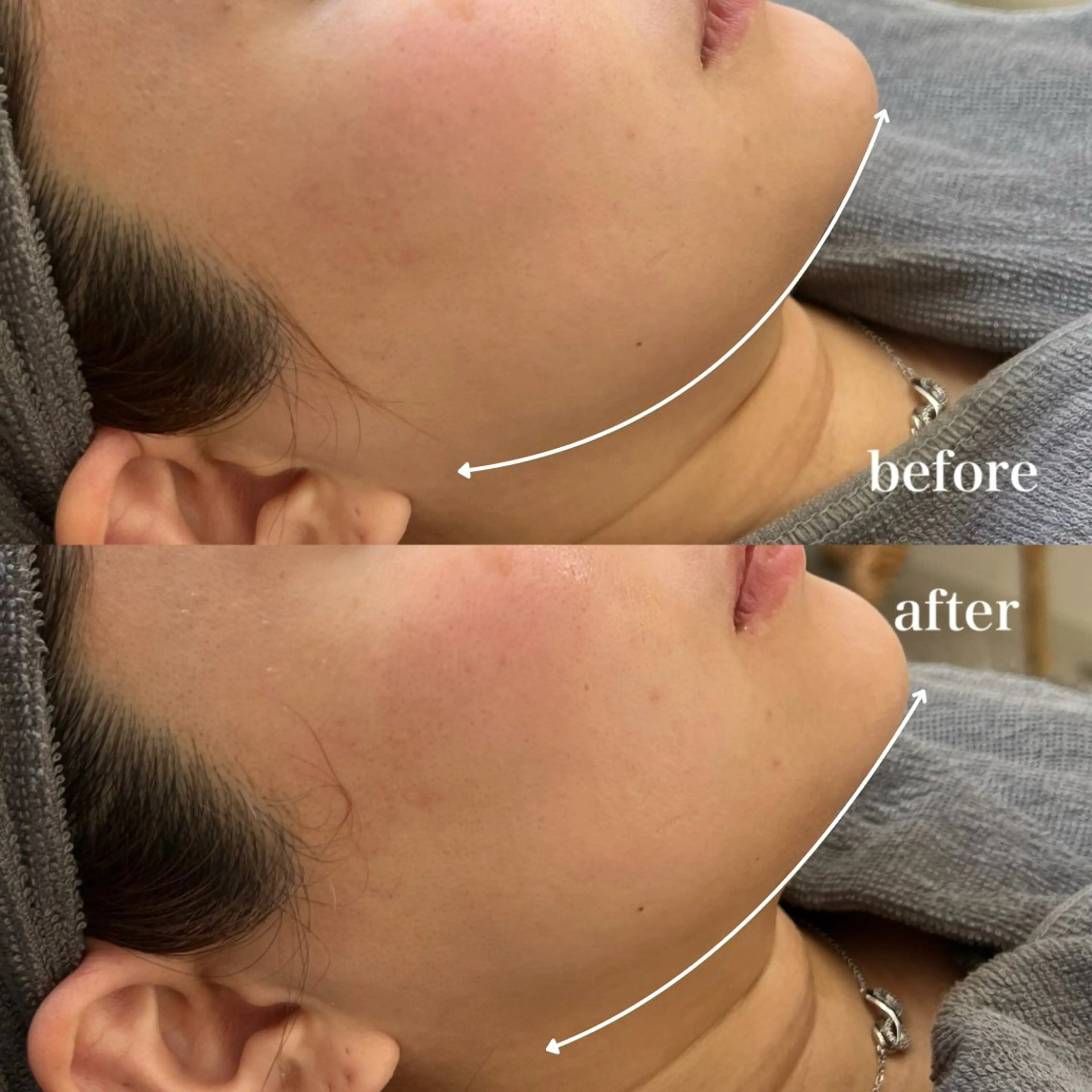 エステ 🌿hitomi🌿 艶肌/肌質改善のエステ・リラクイメージ