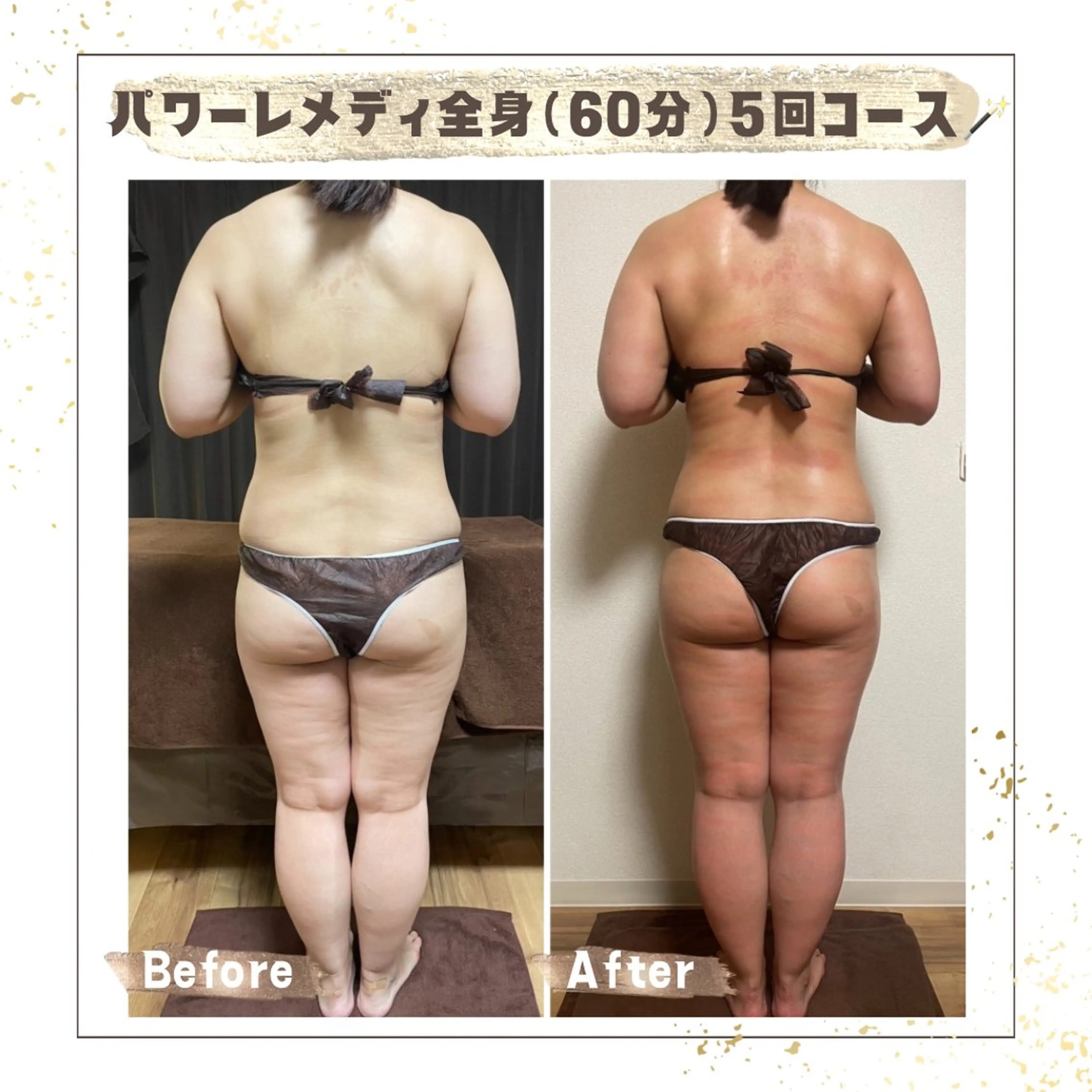 エステ リラク Luca所属・Luca 痩身• 疲労改善×韓国肌管理のエステ・リラクイメージ