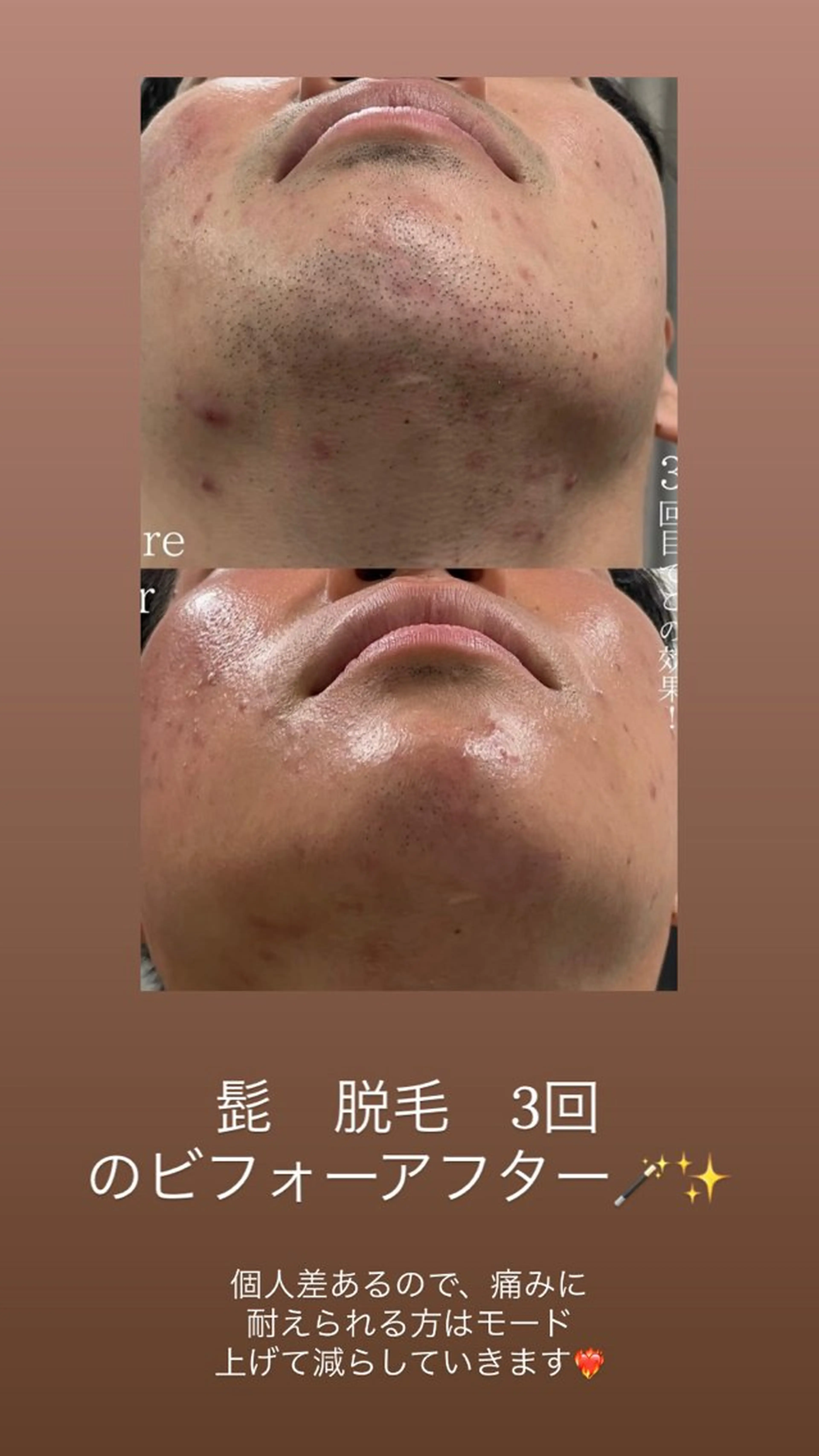 KARIN/りあみか /眉毛/まつげ/脱毛のマツエク・マツパデザイン