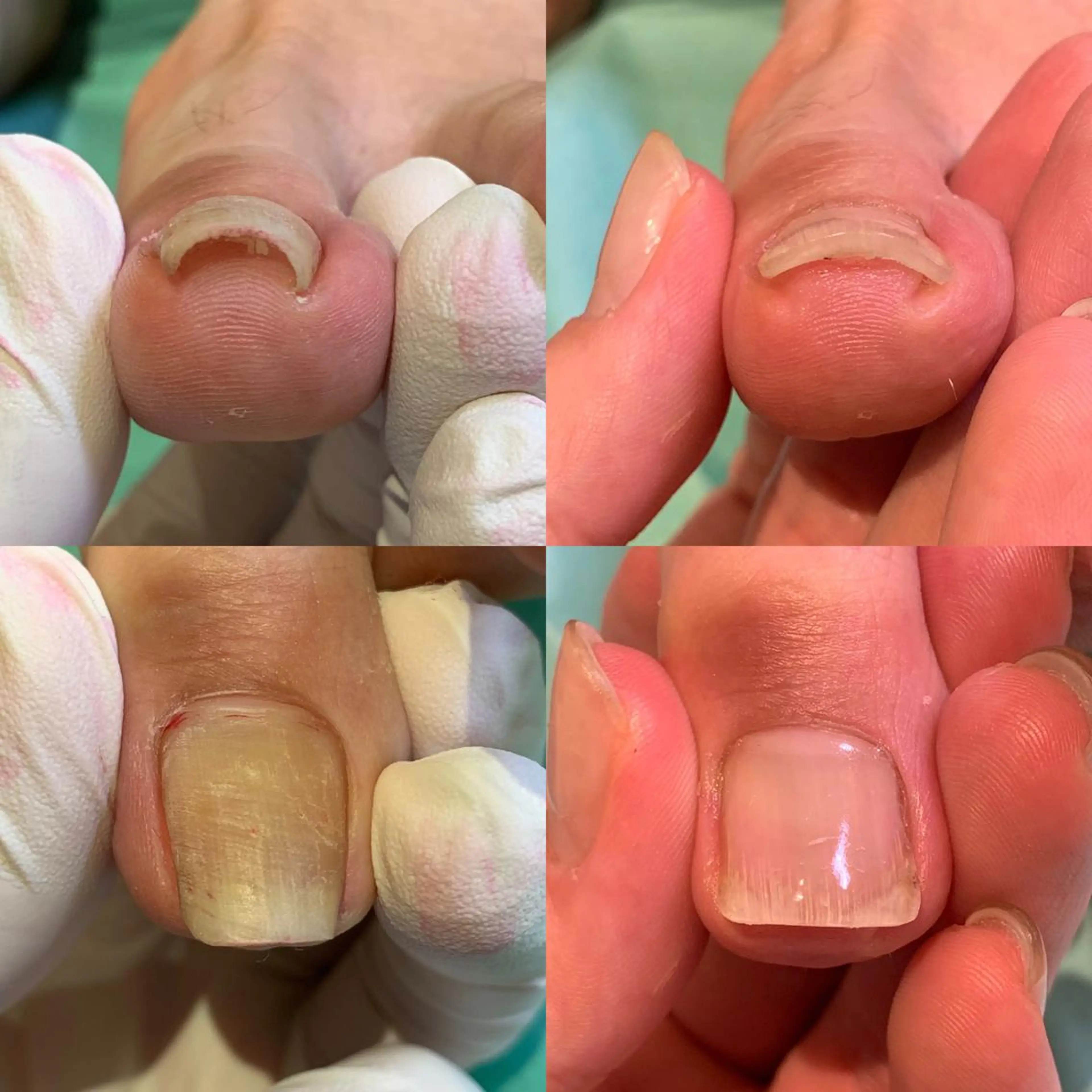 ネイル 東京巻き爪アカデミー所属・東京巻き爪 アカデミーのエステ・リラクイメージ