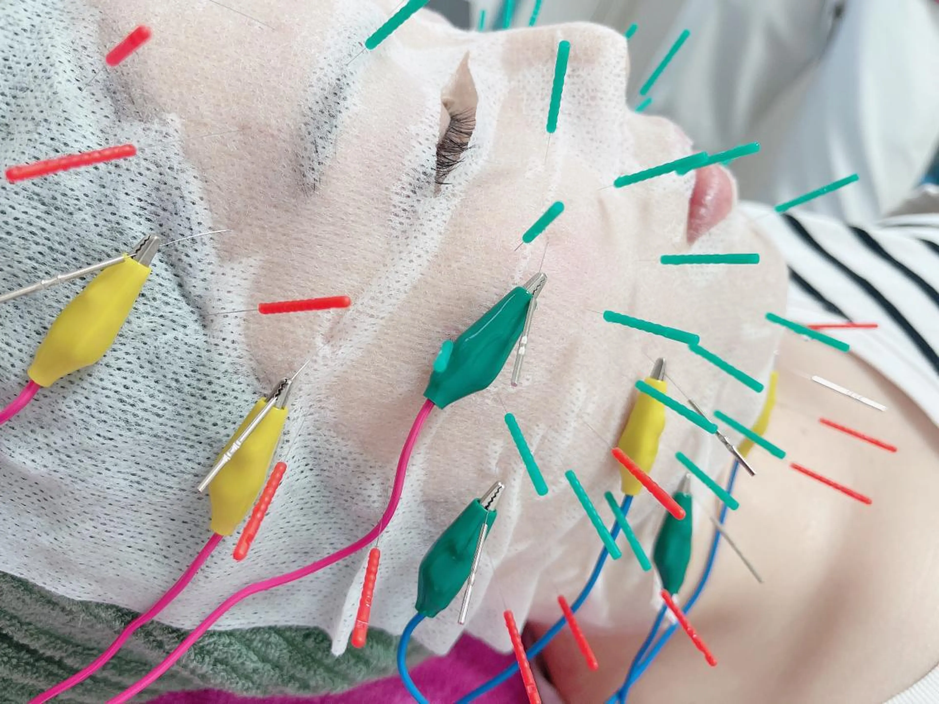 はりすたいる 鍼灸院のエステ・リラクイメージ