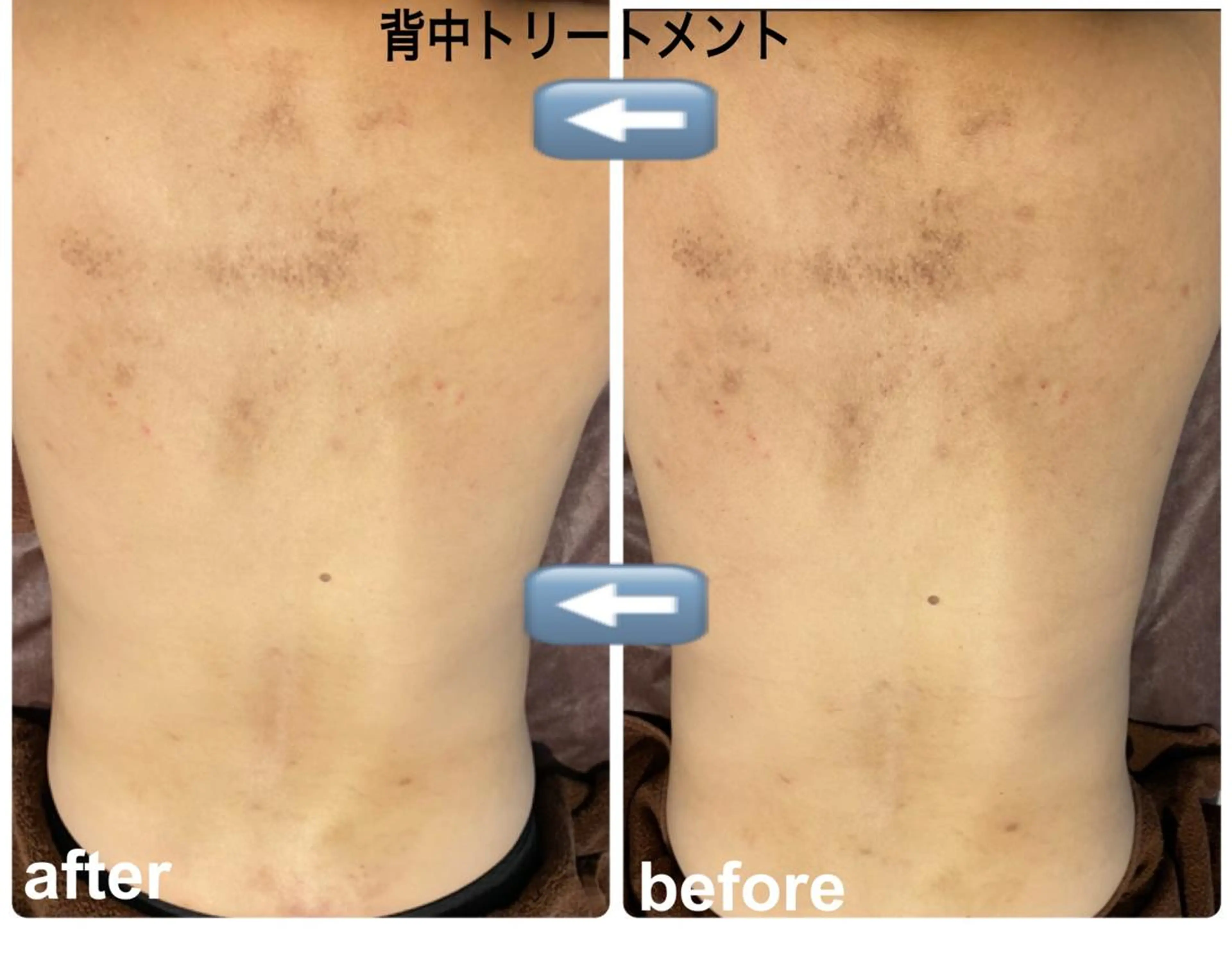 Fleur フルールのエステ・リラクイメージ