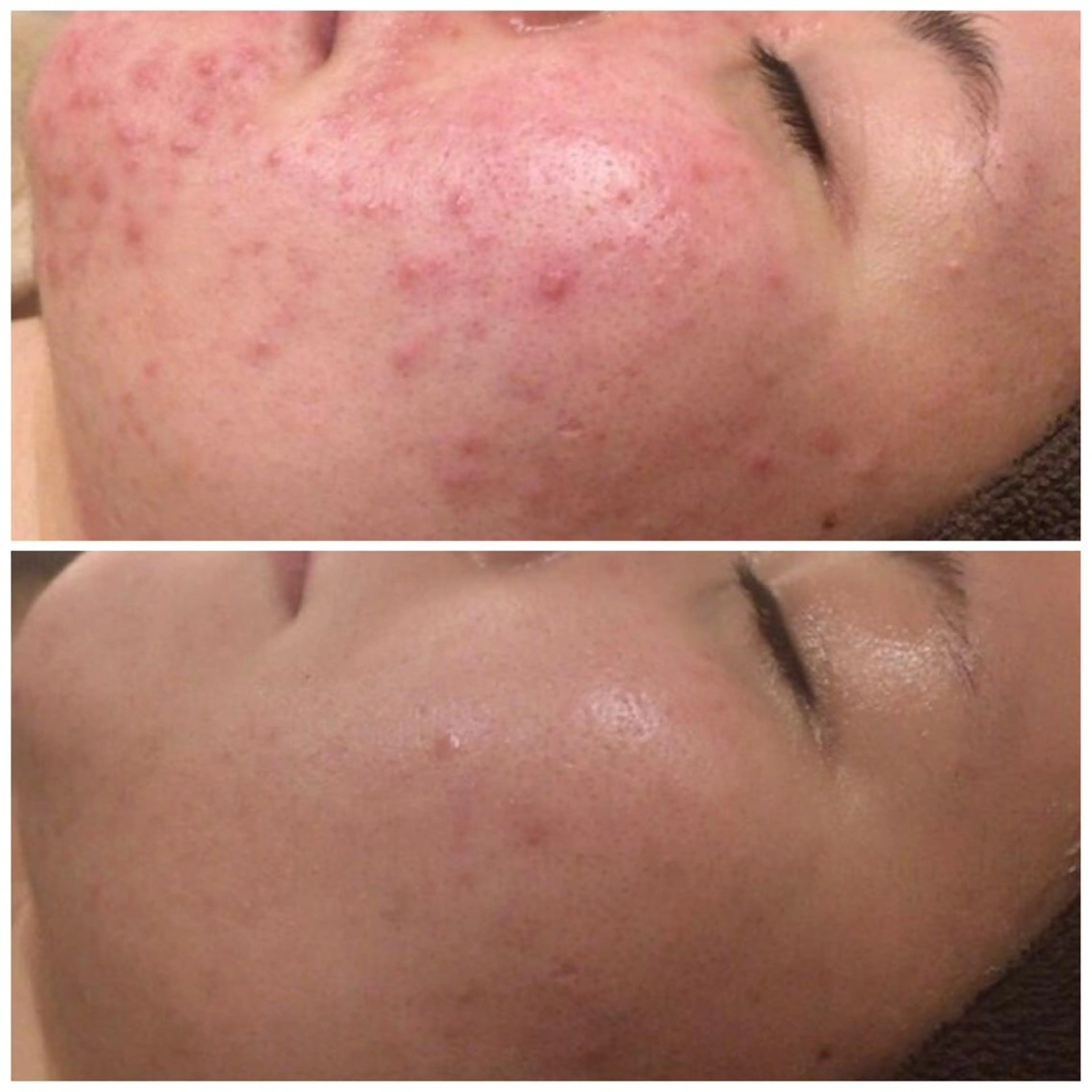 ミディアム カラー パーマ ヘアアレンジ キッズ ネイル マツエク・マツパ アイブロウ エステ リラク 3か月で肌革命👼 ニキビ専門店💫のエステ・リラクイメージ