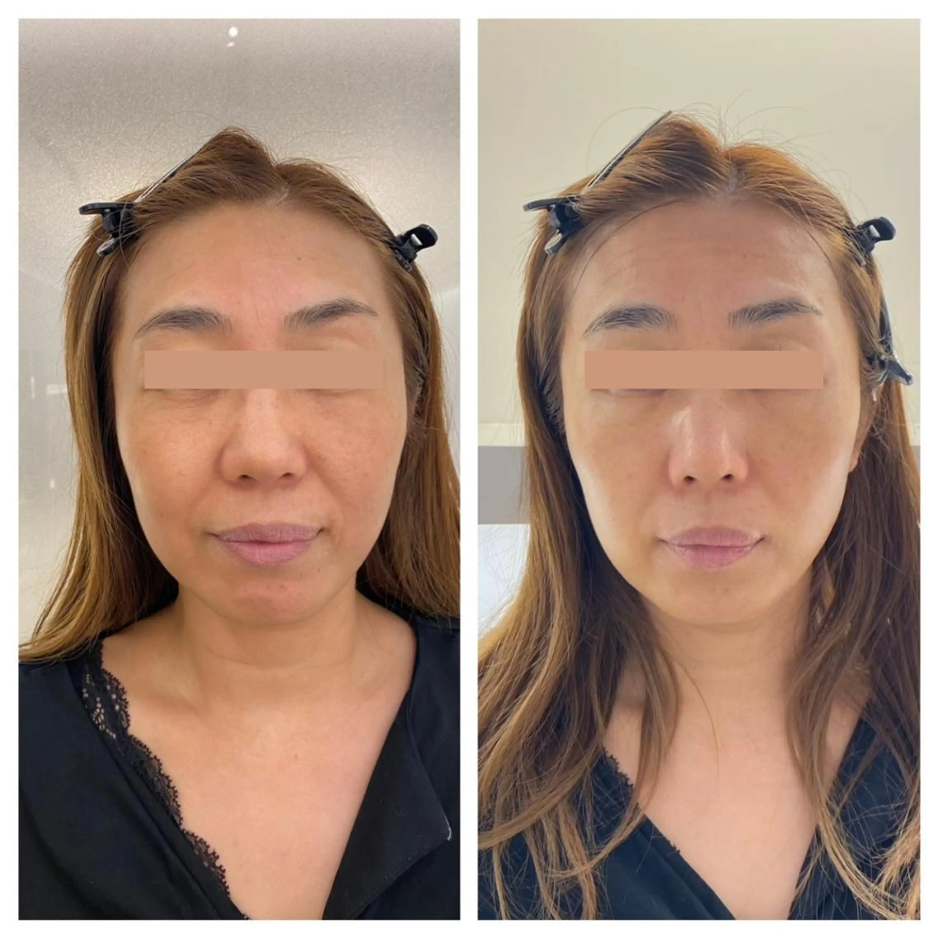 Callana所属・Callana KAYOのエステ・リラクイメージ