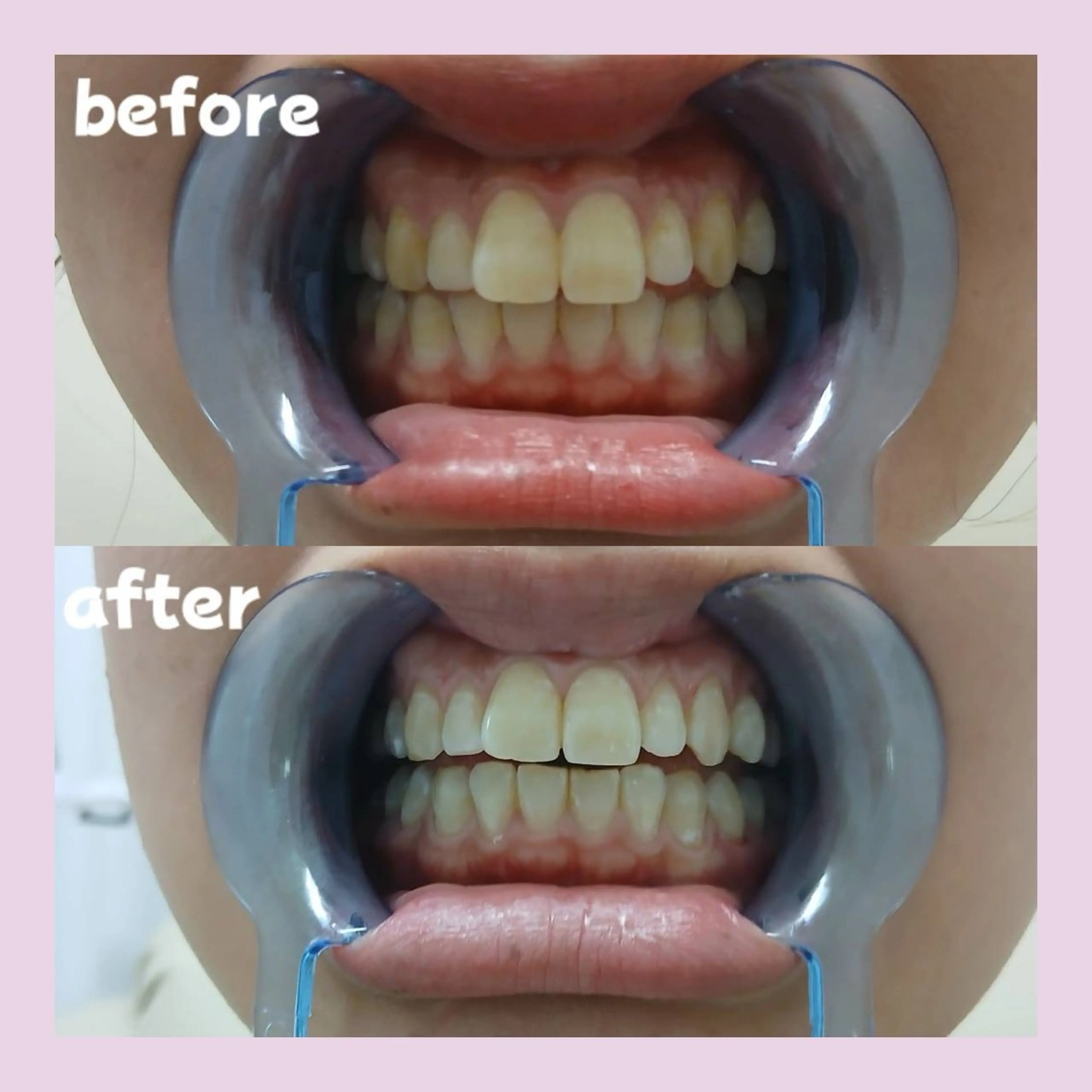 太田 菜那のその他イメージ