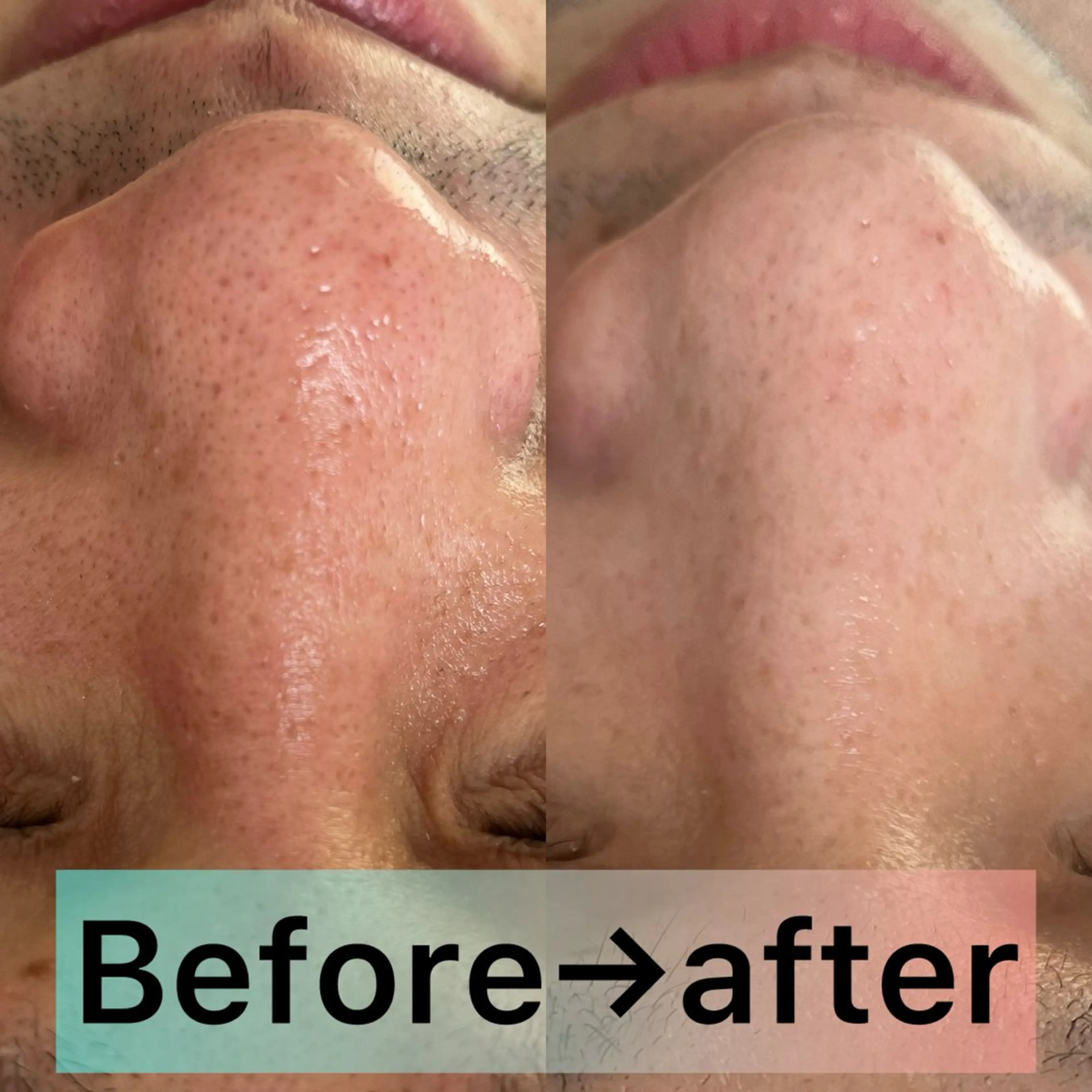 エステ LaBeIIevie ラベルヴィのマツエク・マツパデザイン