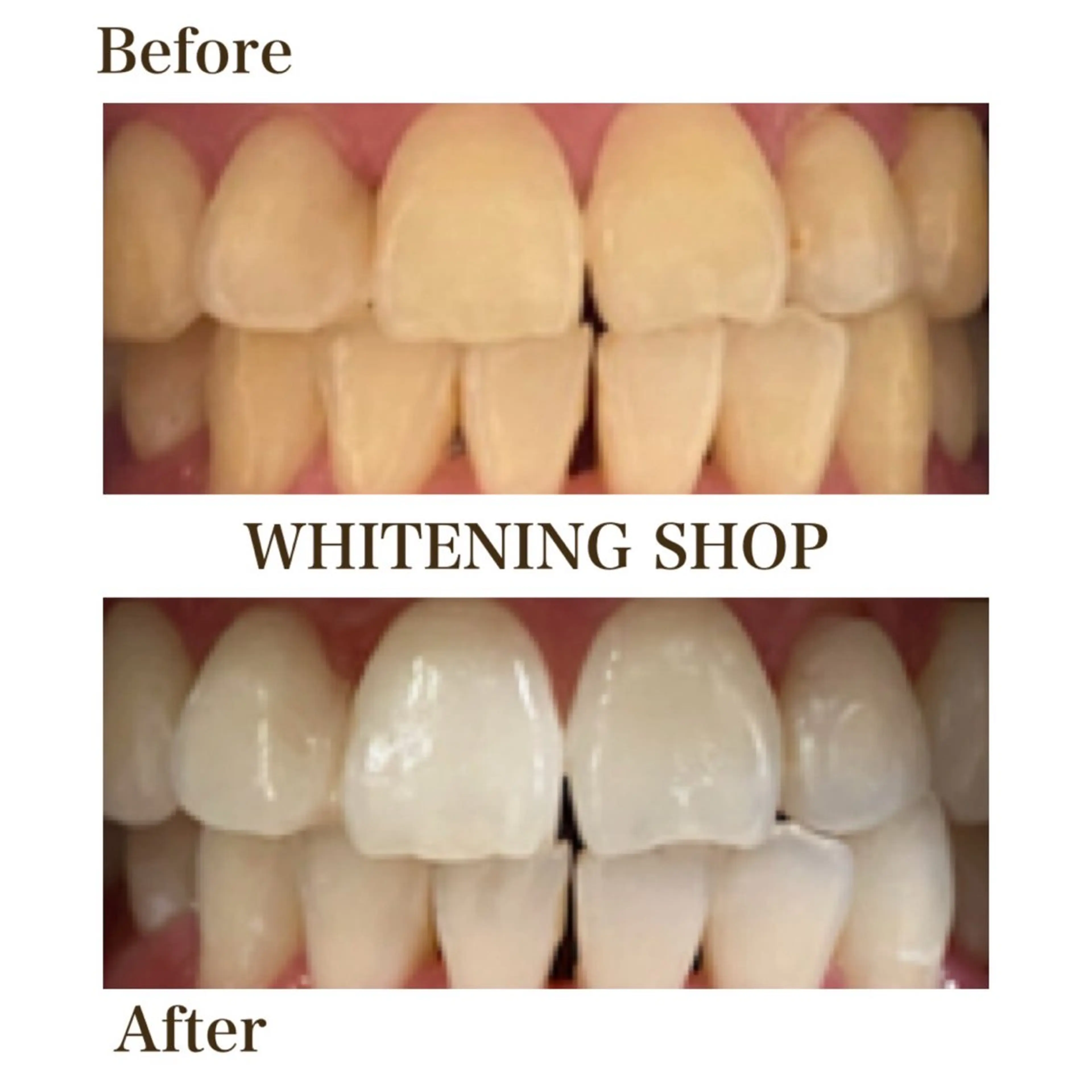 メンズ 学生(メンズ向け) エステ リラク ホワイトニング ショップ川越店のエステ・リラクイメージ