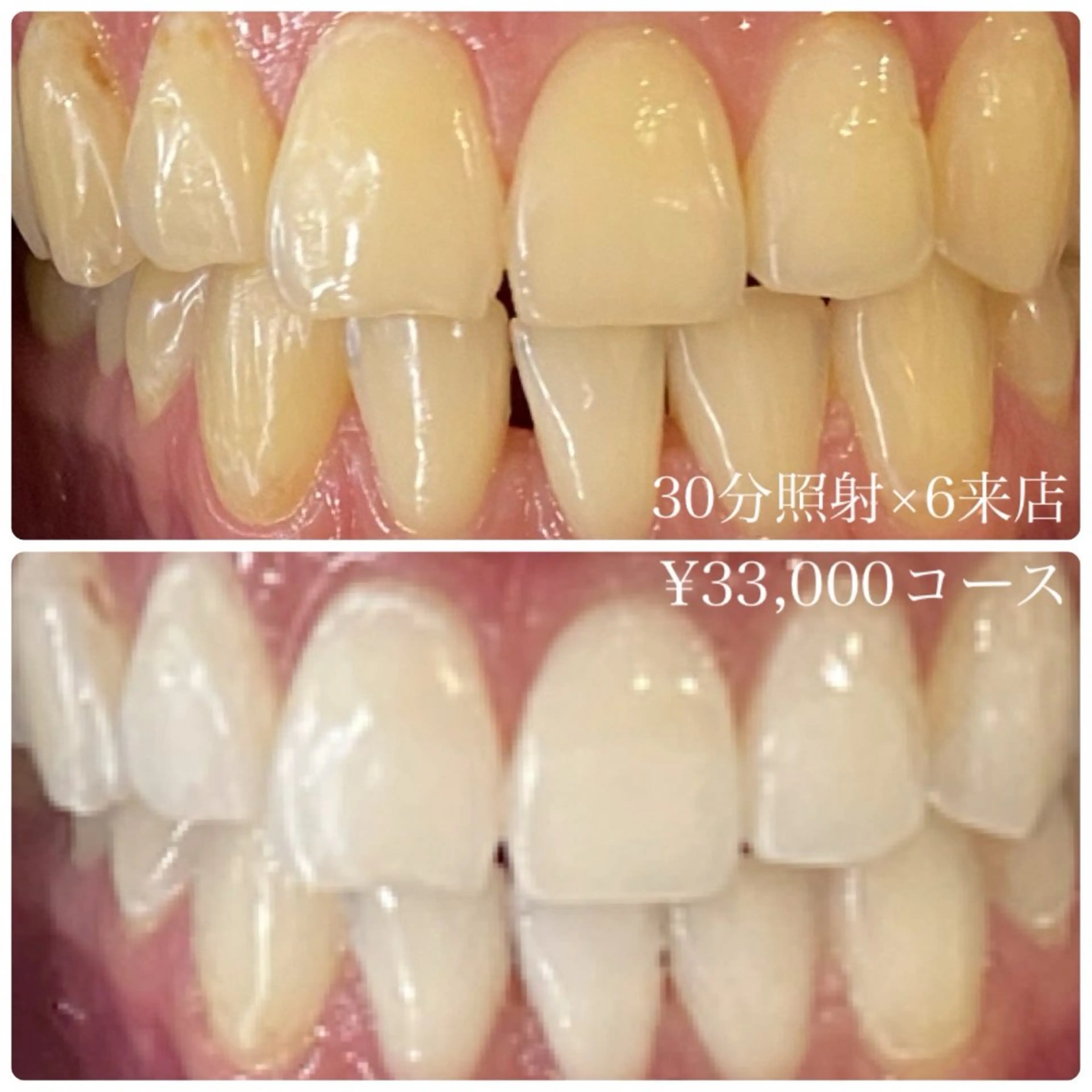 ホワイトニングルーム 横浜店のその他イメージ