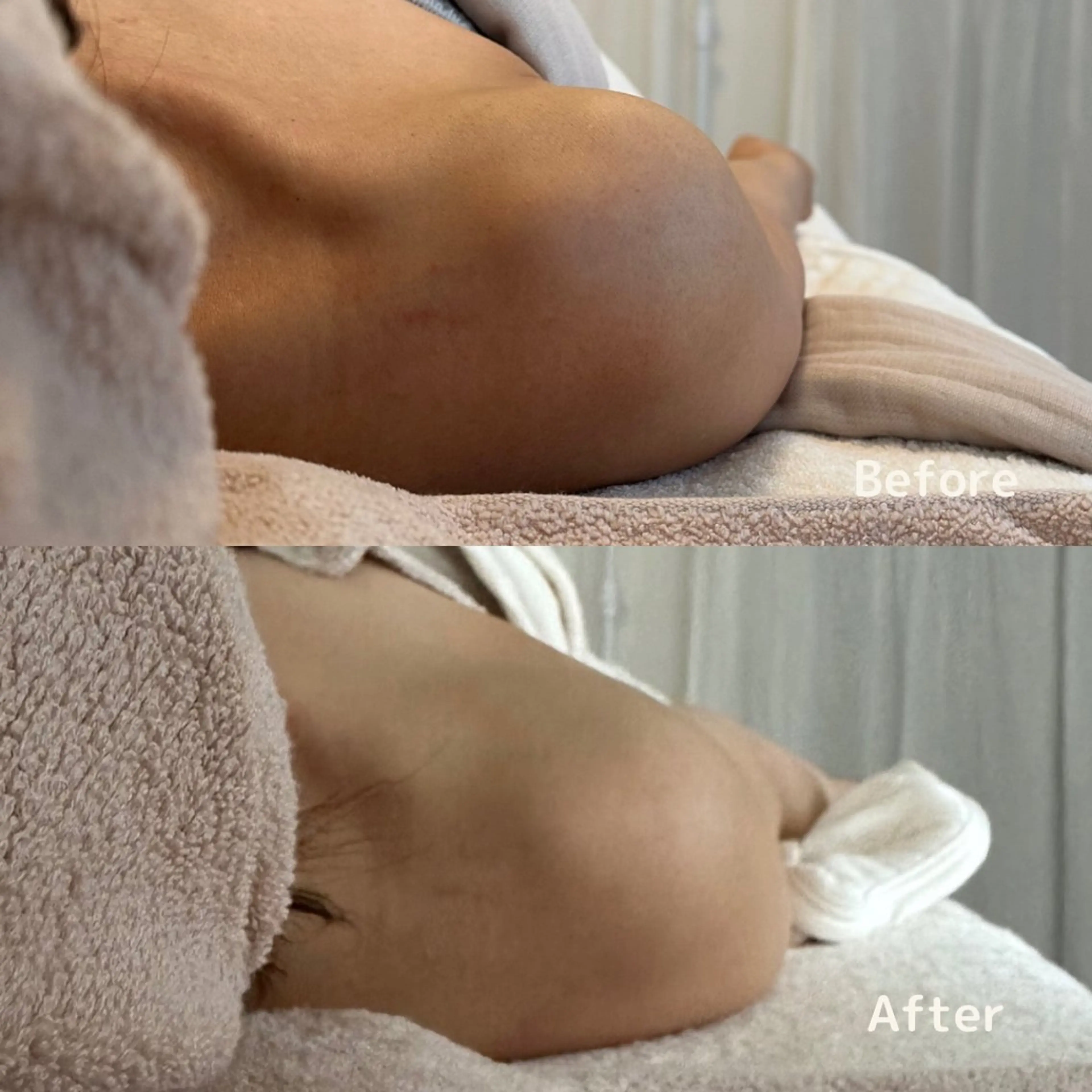 【噛み締め•眼精疲労•自律神経の乱れでお悩みの方はコチラ✨】快眠ヘッドの写真