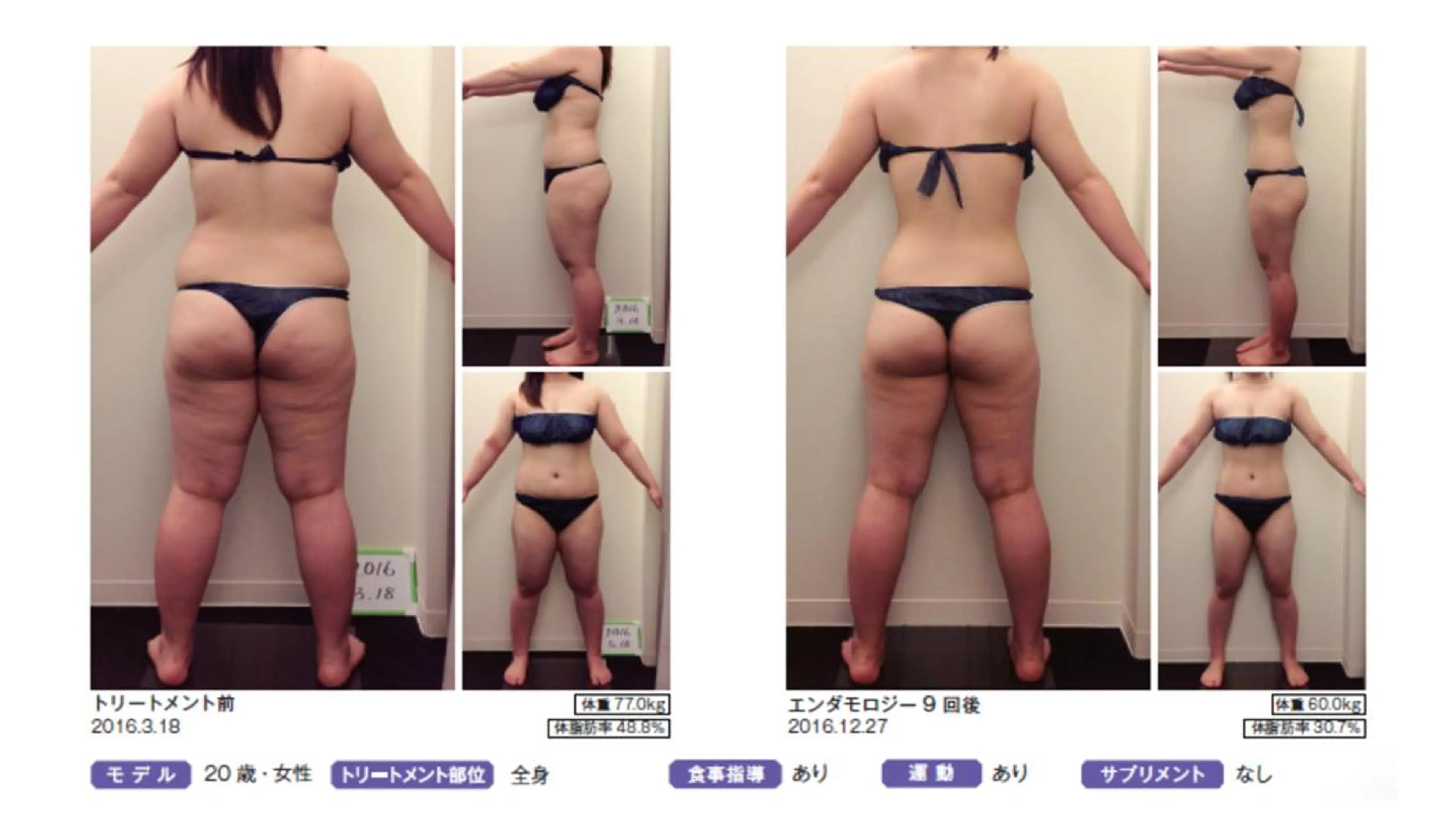 オレンジバナナ 県央店のエステ・リラクイメージ