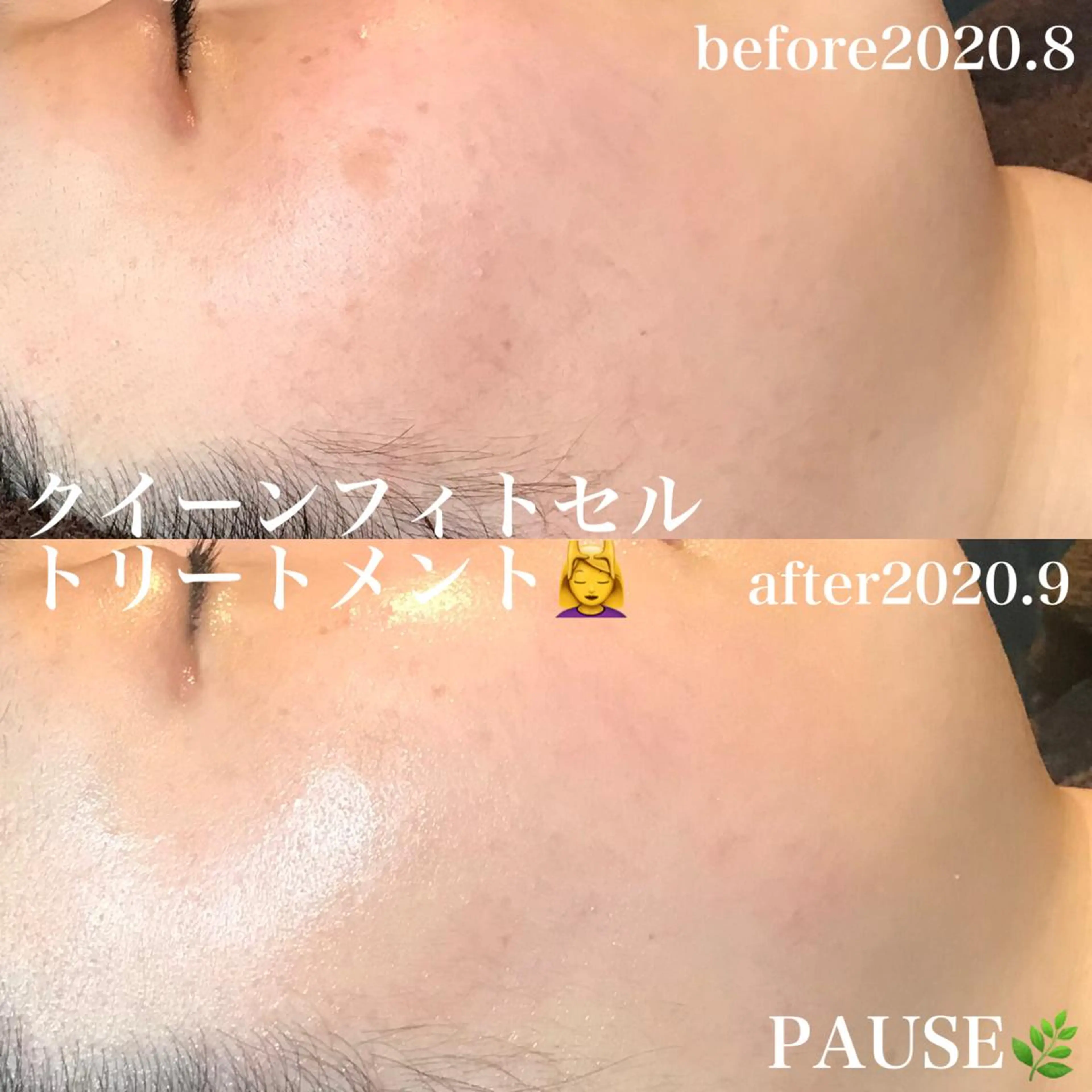 エステ 浜野 恵美のエステ・リラクイメージ