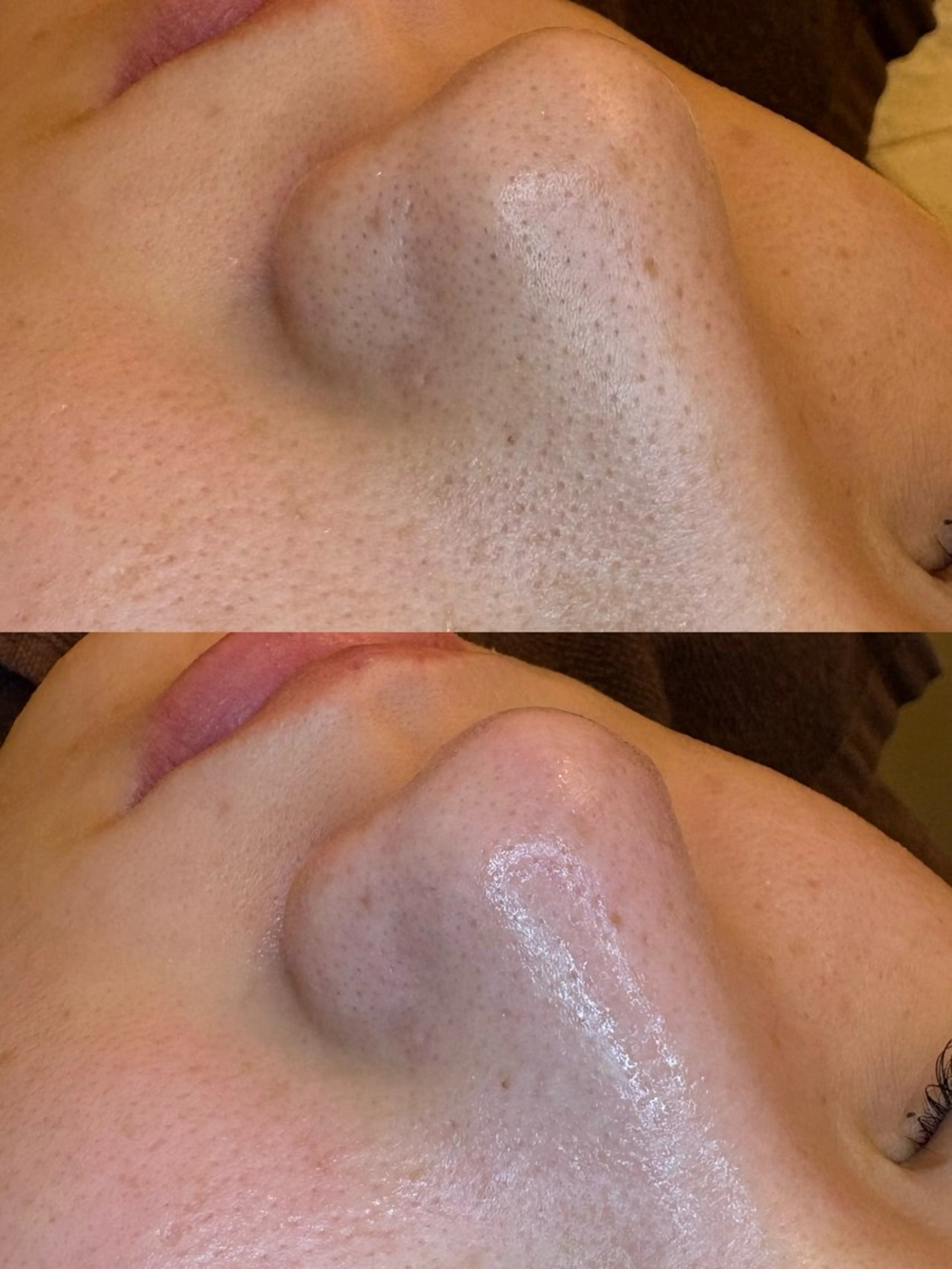 🤍アベシュリ /フェイシャル🤍のエステ・リラクイメージ