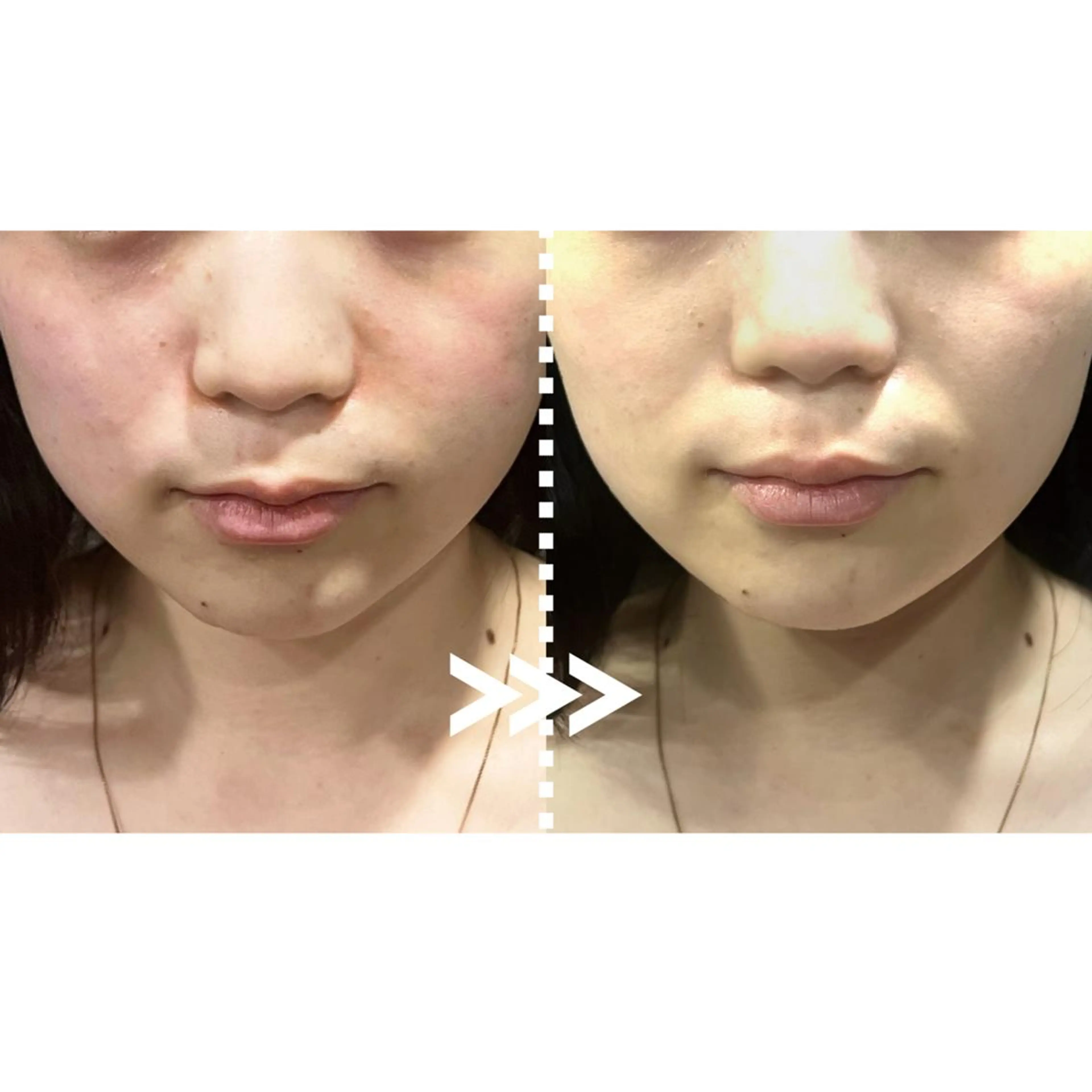 肌質改善専門 ハーブ /毛穴洗浄 リエイトのエステ・リラクイメージ