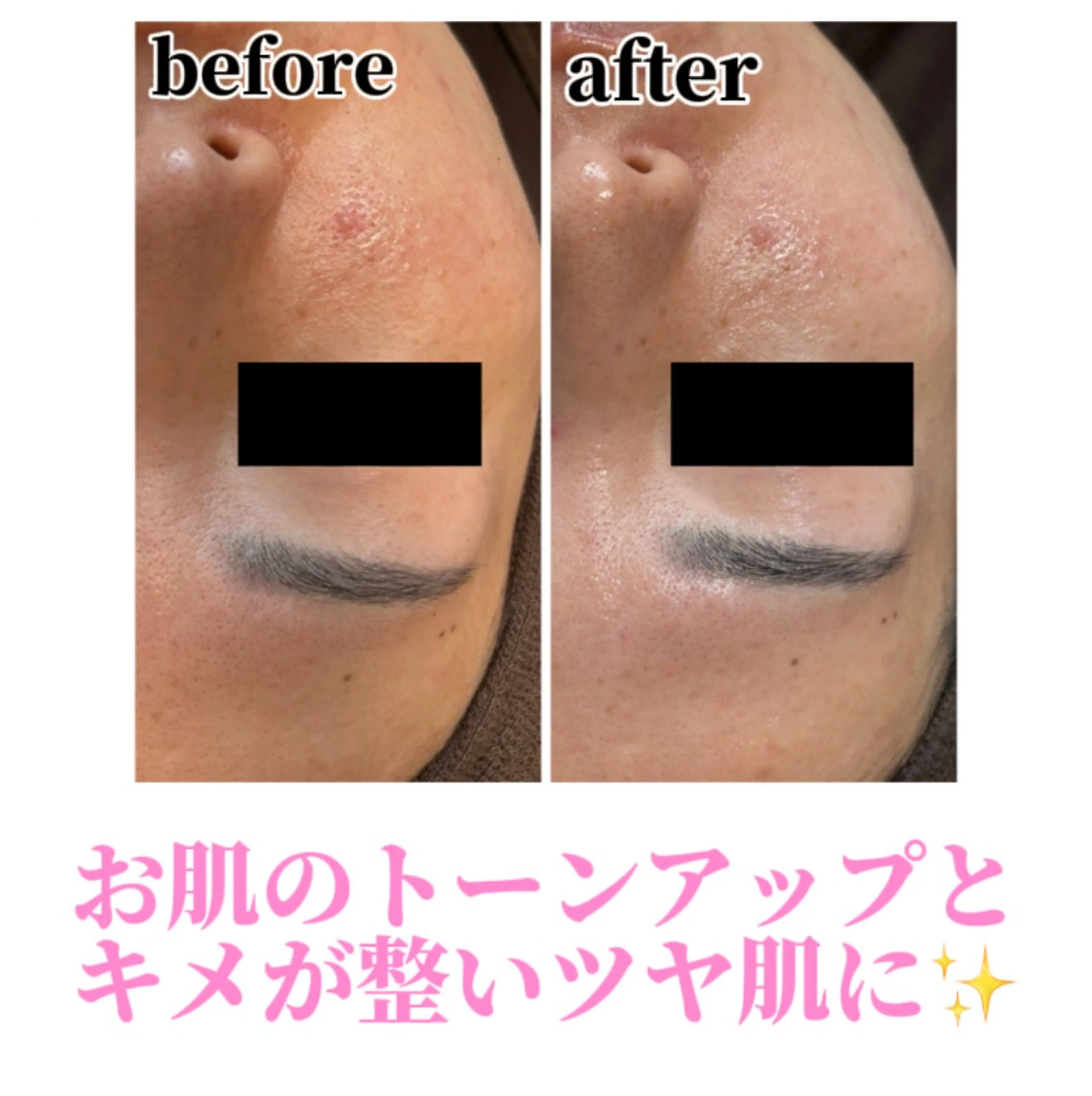 エステ Beauty salonBellのエステ・リラクイメージ
