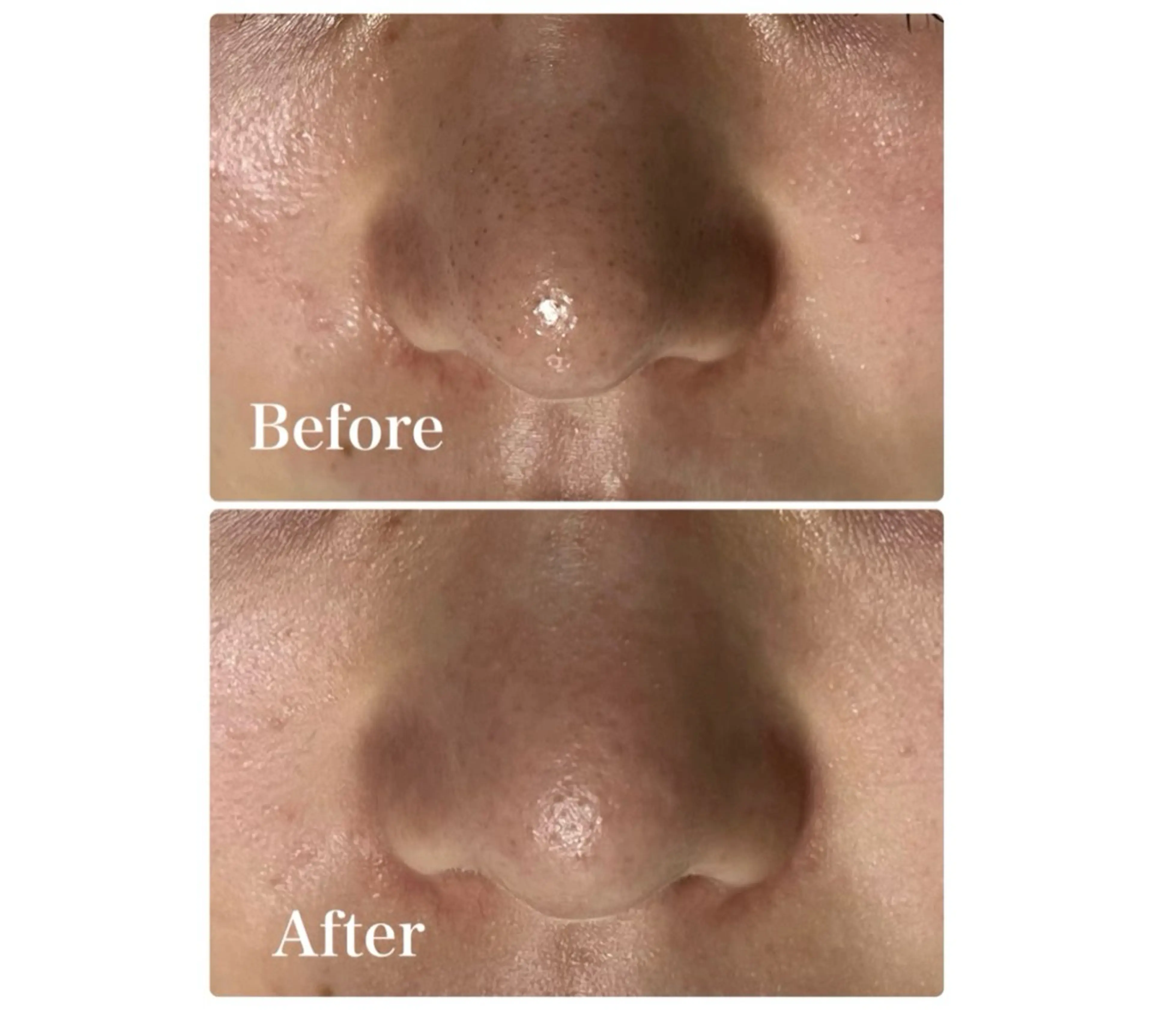 エステ ROR Akariのエステ・リラクイメージ