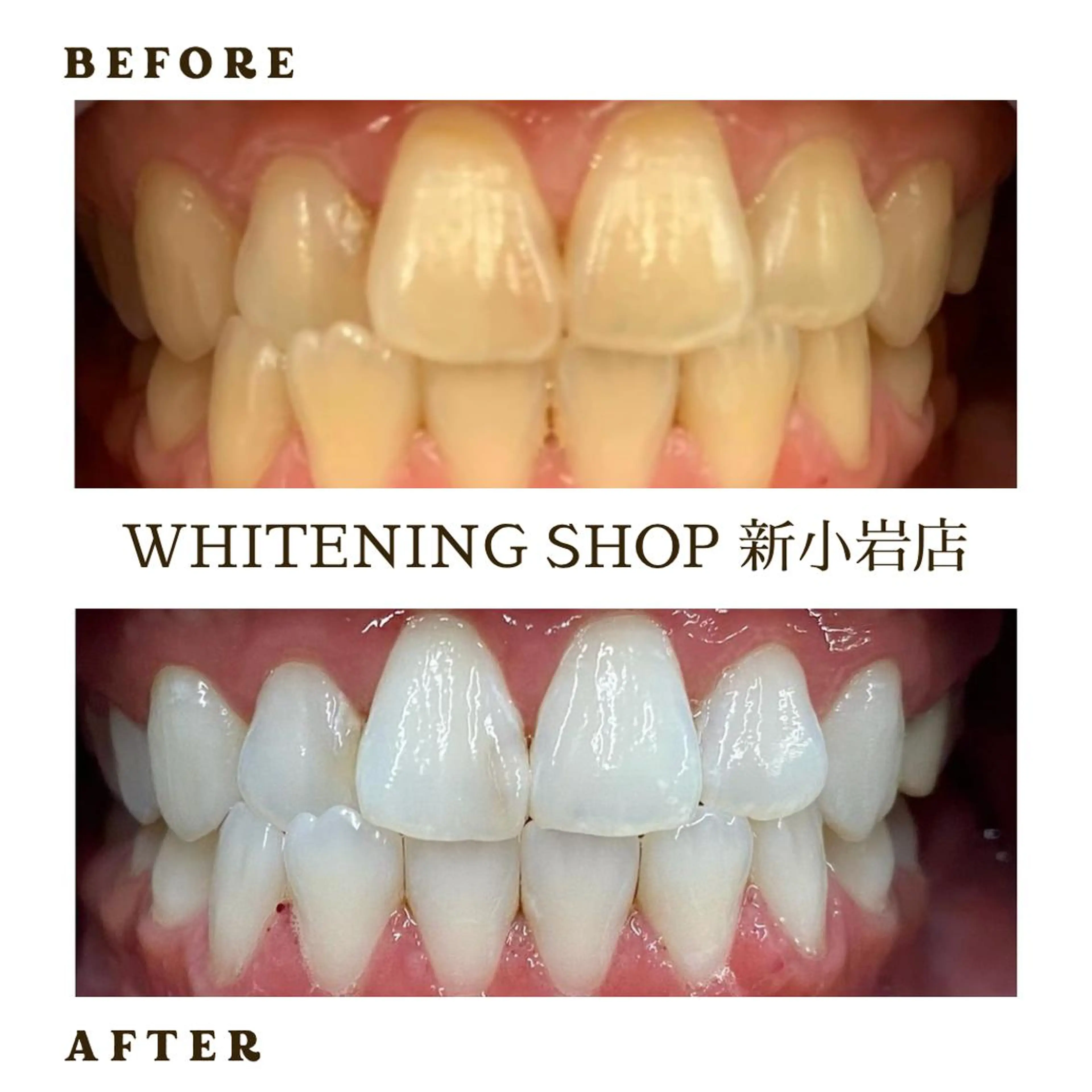 その他 ホワイトニング ショップ新小岩店のその他イメージ