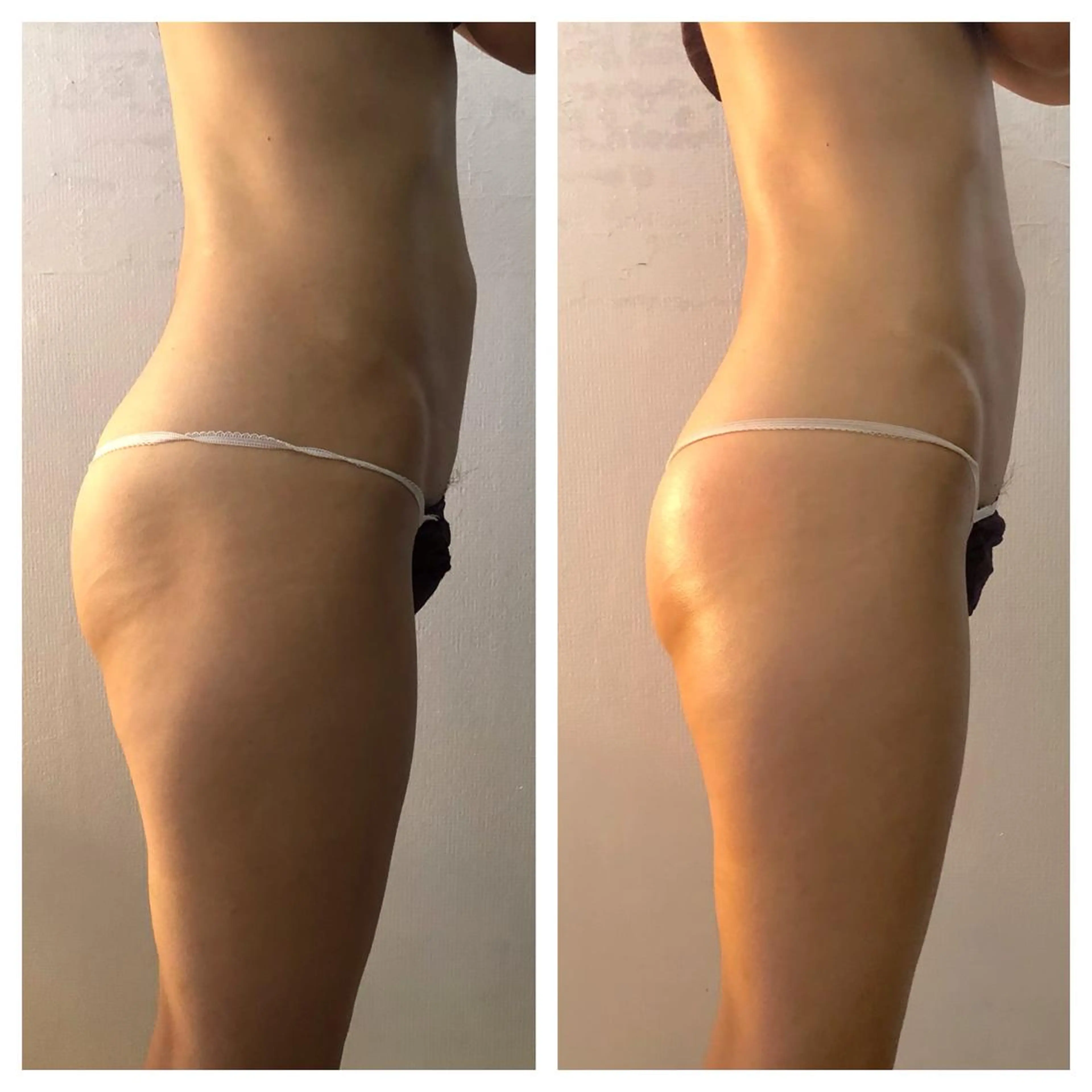 小顔・痩身専門店 Sunao所属・小顔.足痩せ整体 痩身天六Sunaoのその他イメージ