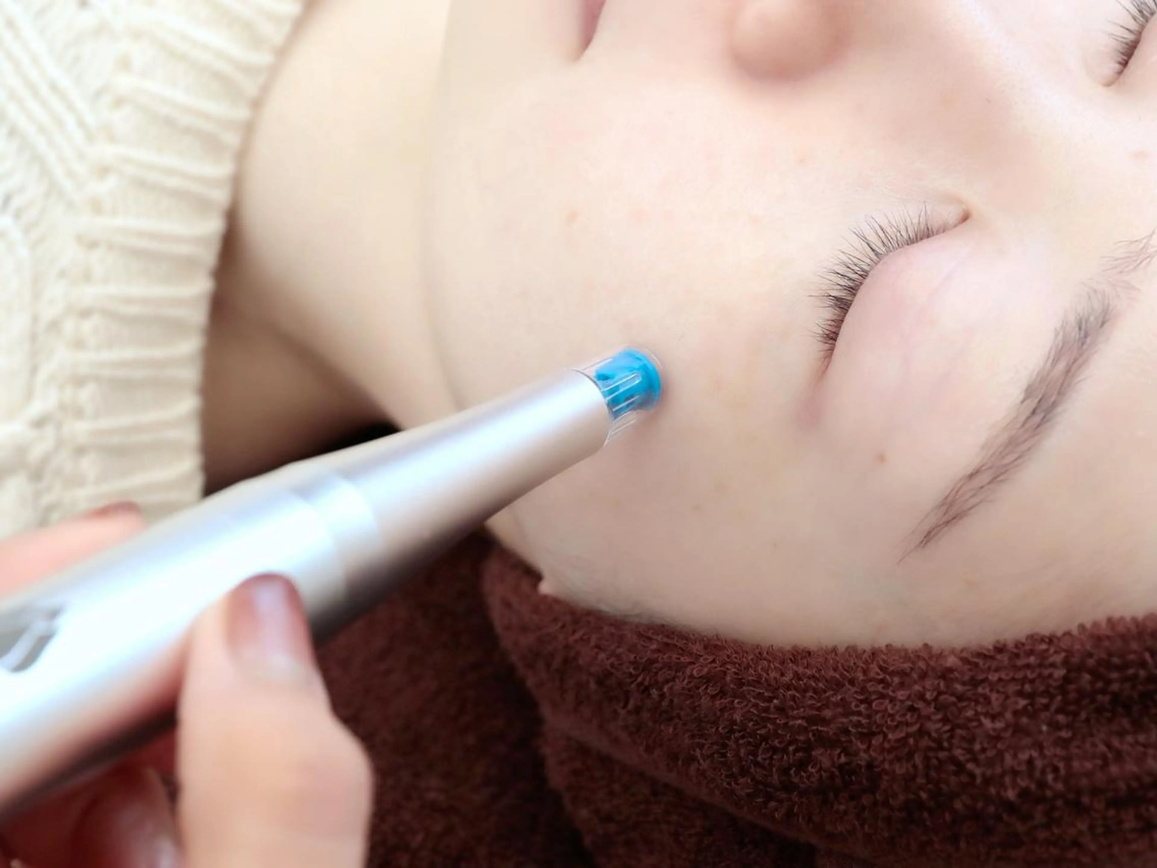 エステ版ダーマペン🖋リゼネレート✨痛み・赤み・ダウンタイムなし！毛穴の開き・黒ずみ・小じわ・ニキビ跡etc..の写真