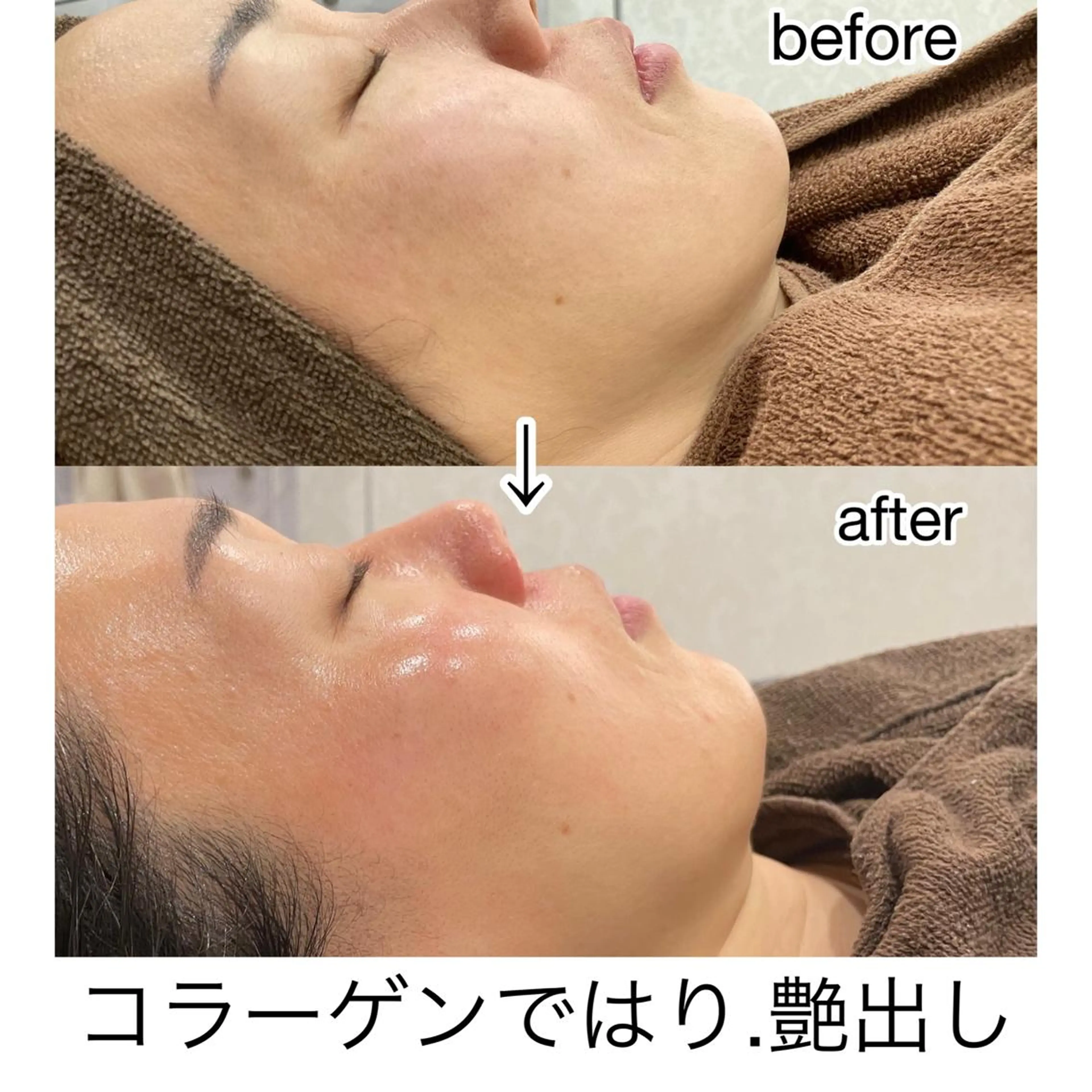 エステ laluna saki...のその他イメージ