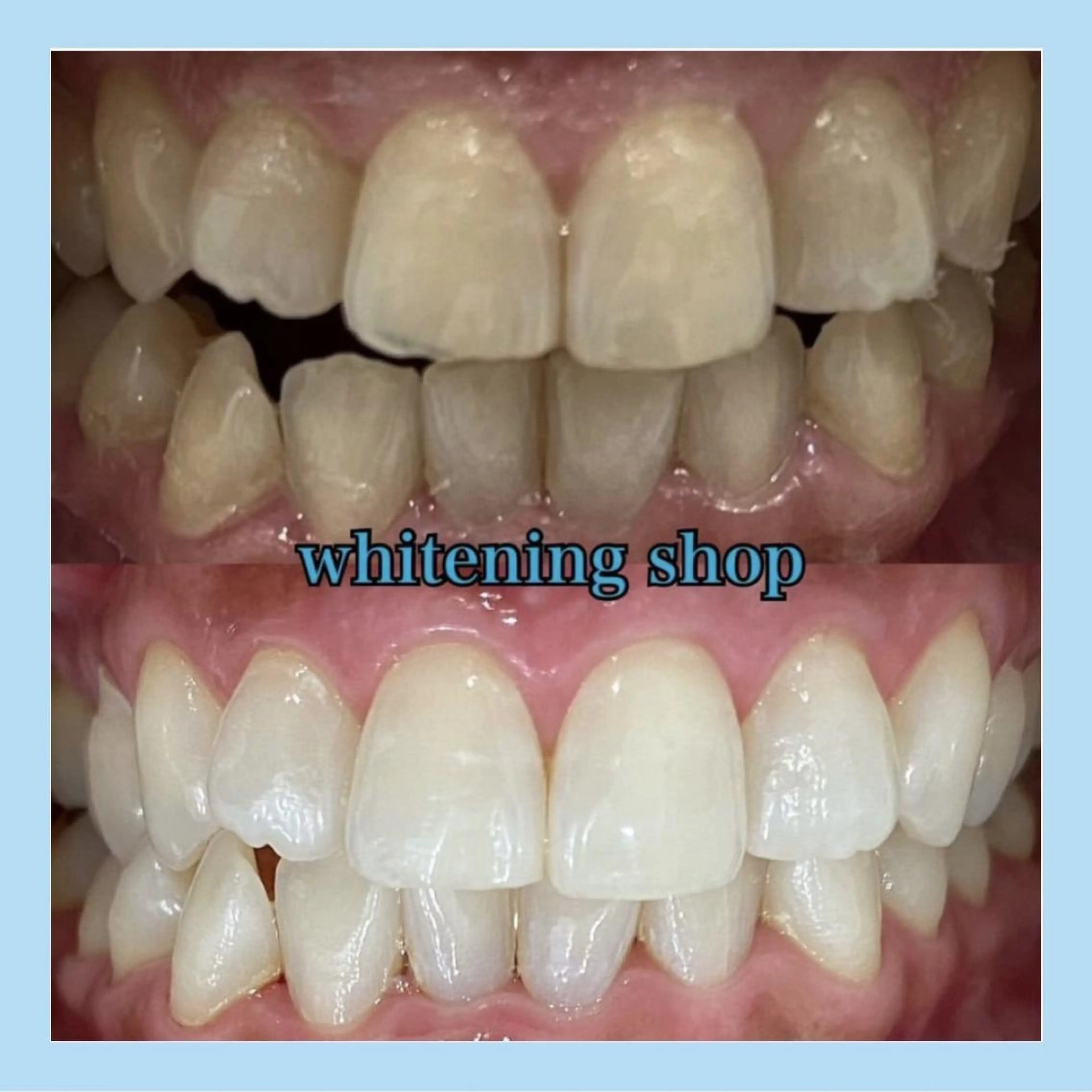 ホワイトニング ショップ千葉店のその他イメージ