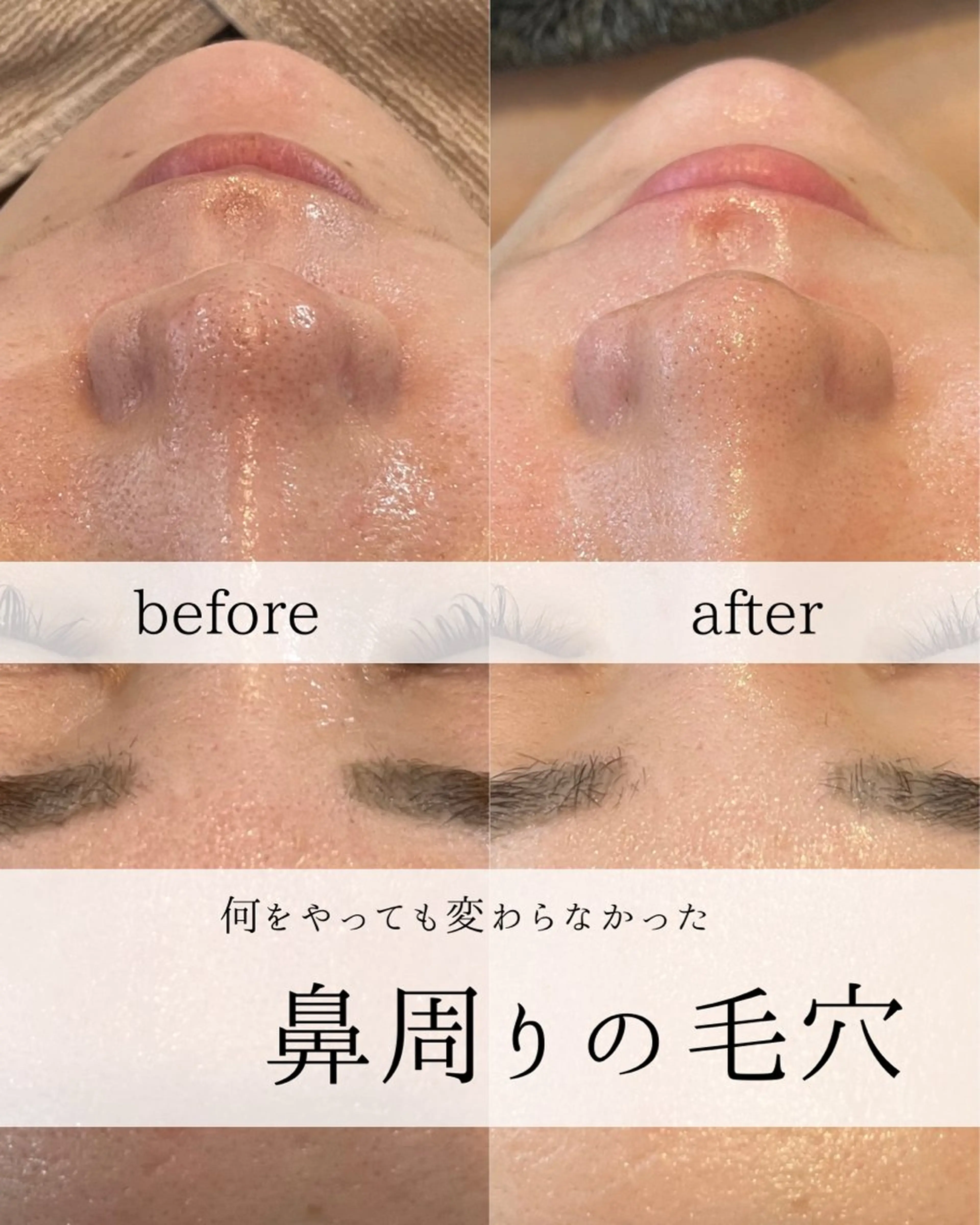 yc.hacci 【ハーブピーリング】の眉毛・アイブロウイメージ