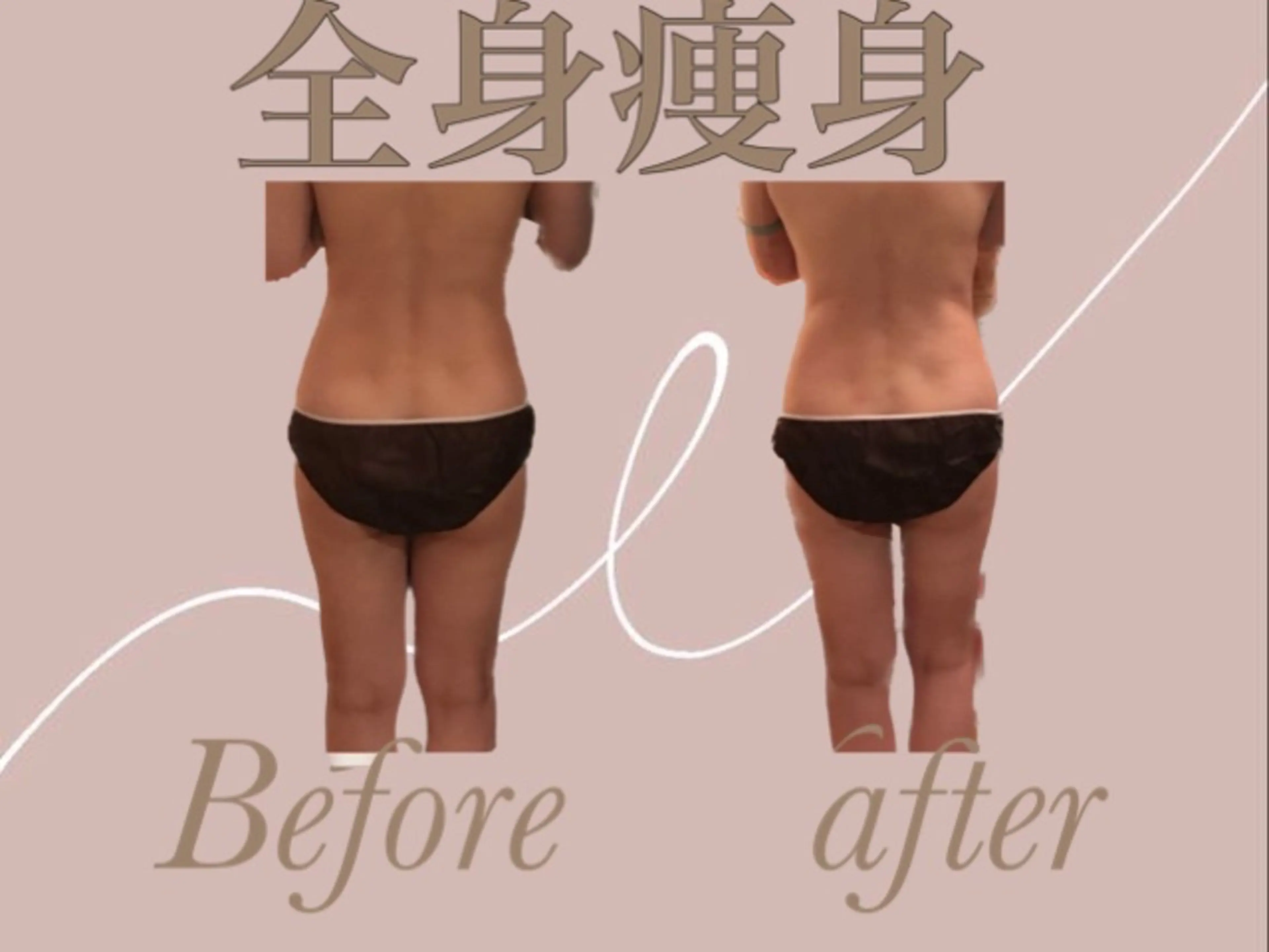 温活痩身サロン LILYのエステ・リラクイメージ