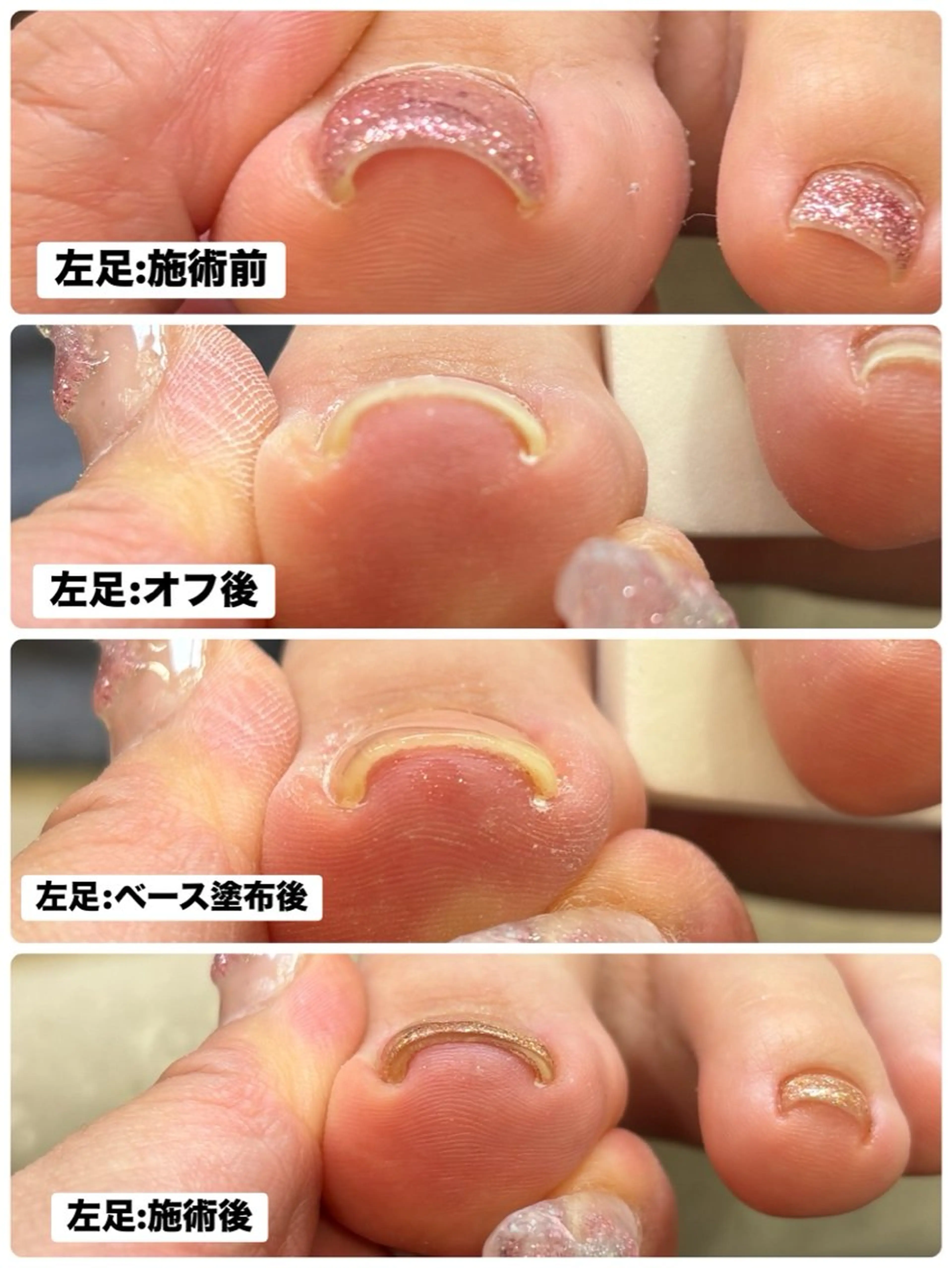 ネイル ジェルネイル マグネットネイル パラジェル フットネイル Blue daisy 栄本店のネイルデザイン