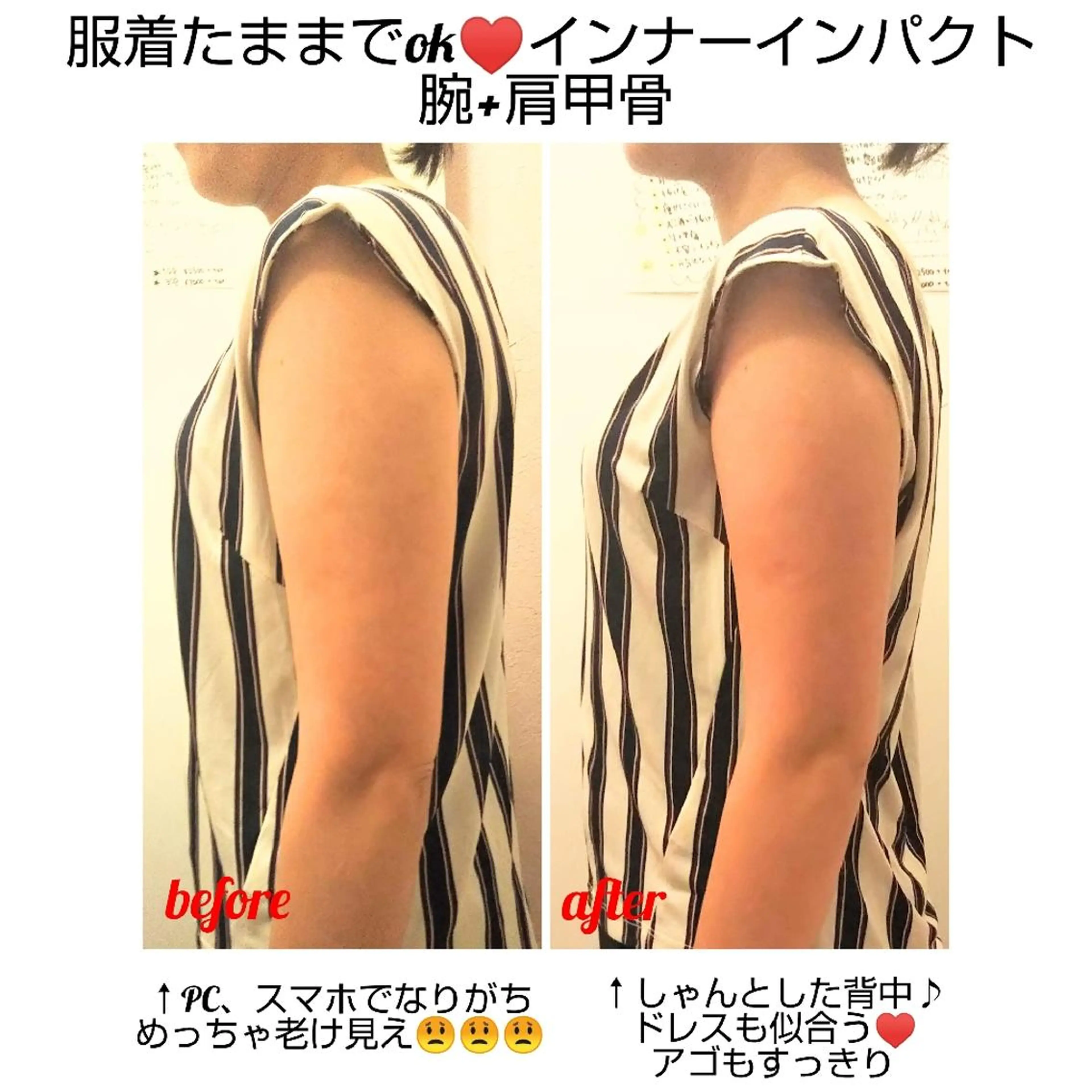 【ニキビ/肌管理】 salon varyのエステ・リラクイメージ