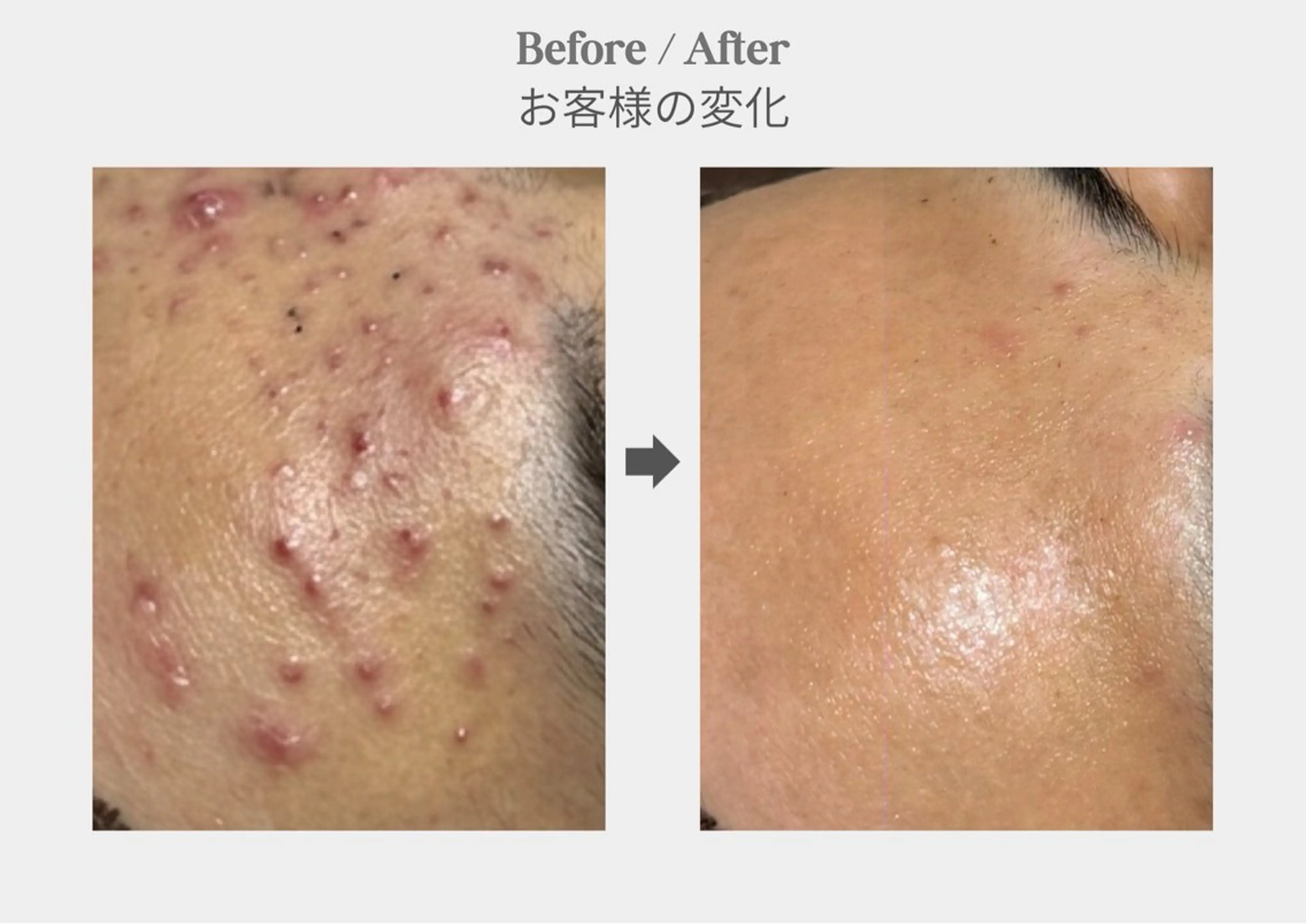 エステ 店長 RUNAのエステ・リラクイメージ