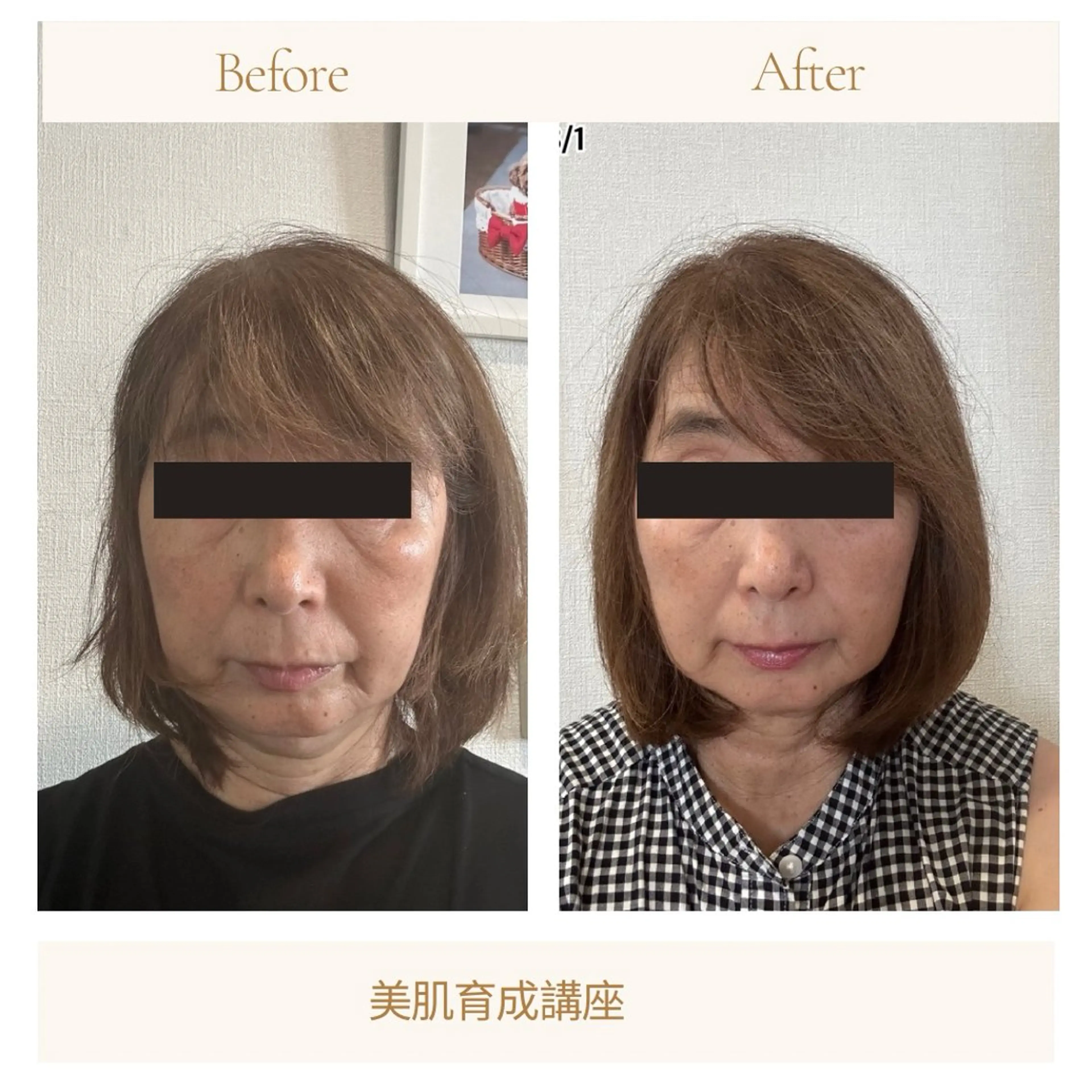 小顔・たるみ改善 ラディアントミューズのエステ・リラクイメージ