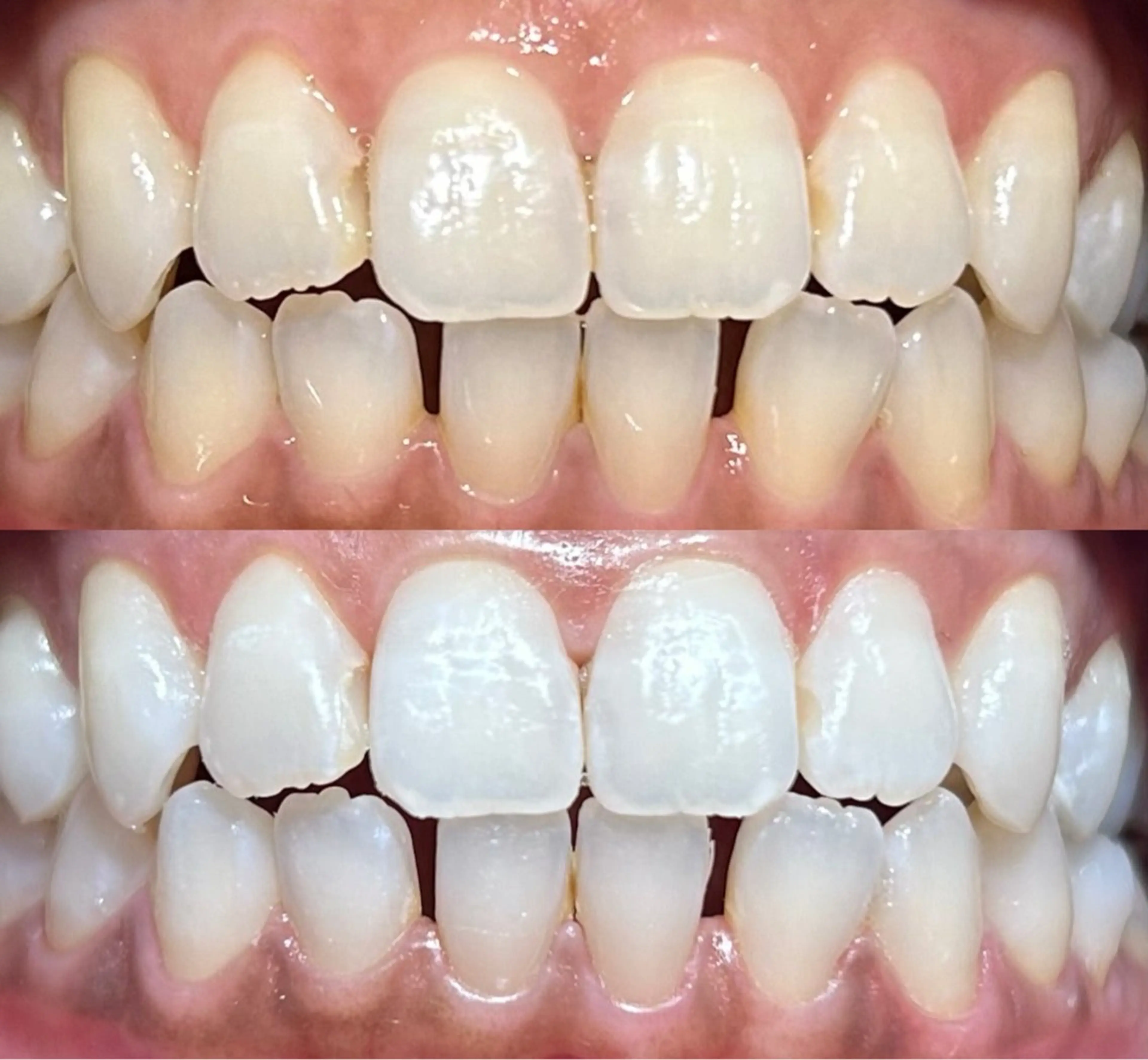 io teeth careのその他イメージ