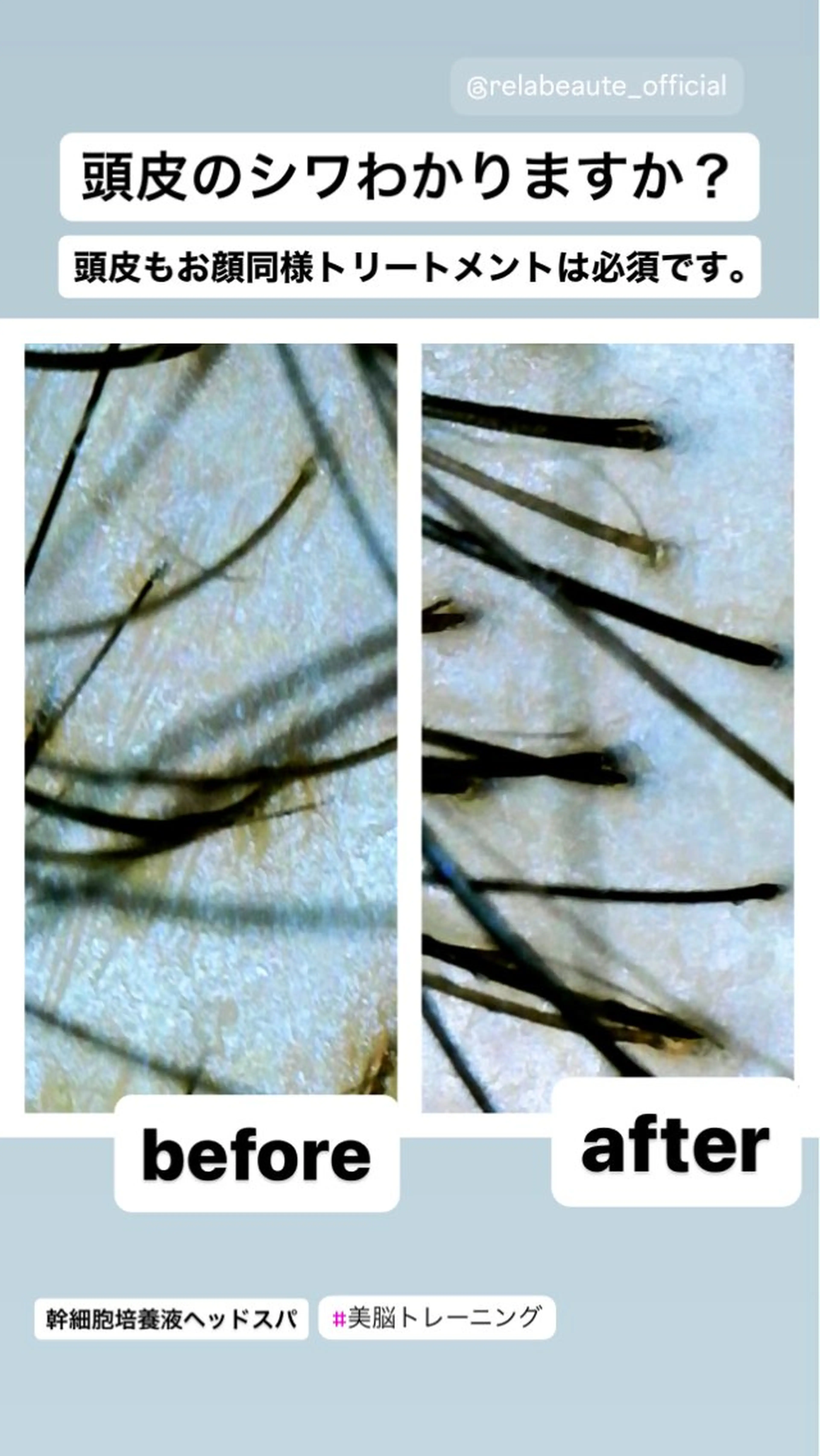 リラク 🅖🅤🅩🅔🅛 salonのエステ・リラクイメージ