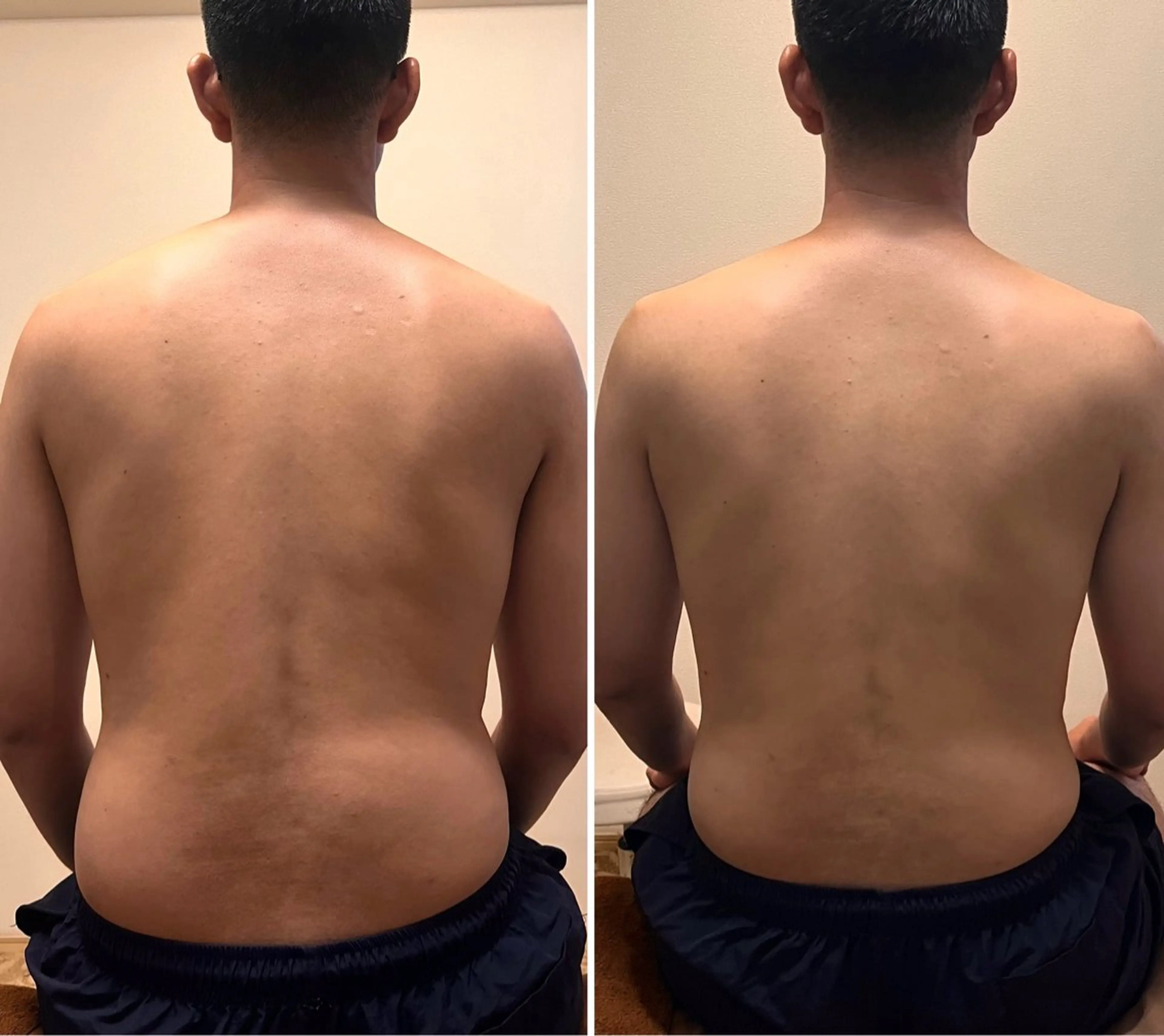 セミロング カラー パーマ ヘアアレンジ メンズ キッズ エステ リラク なりたいボディへ 体質改善のエステ・リラクイメージ