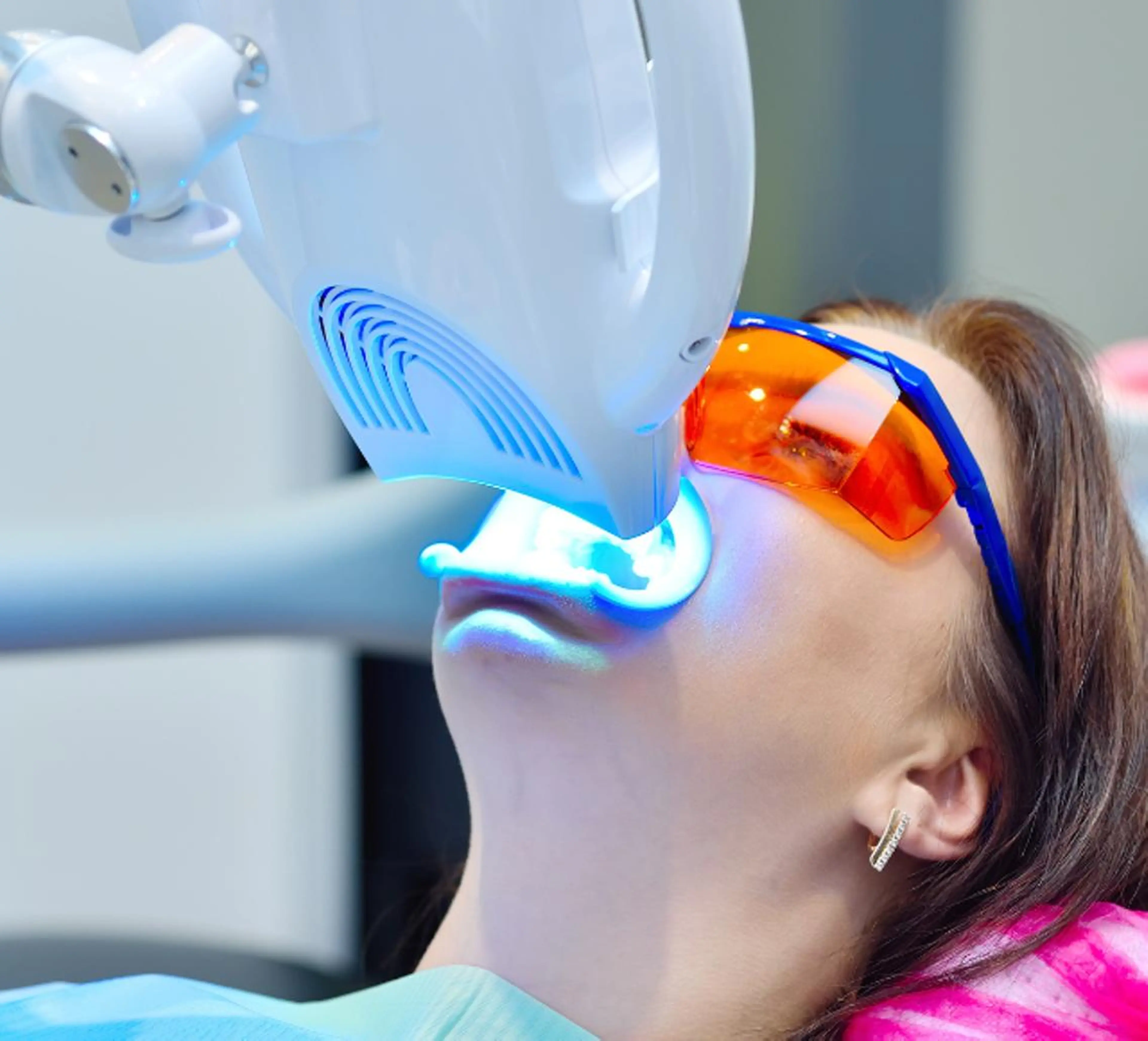 歯の黄ばみ・着色汚れに🦷セルフホワイトニング20分照射コース（10分×２）の写真