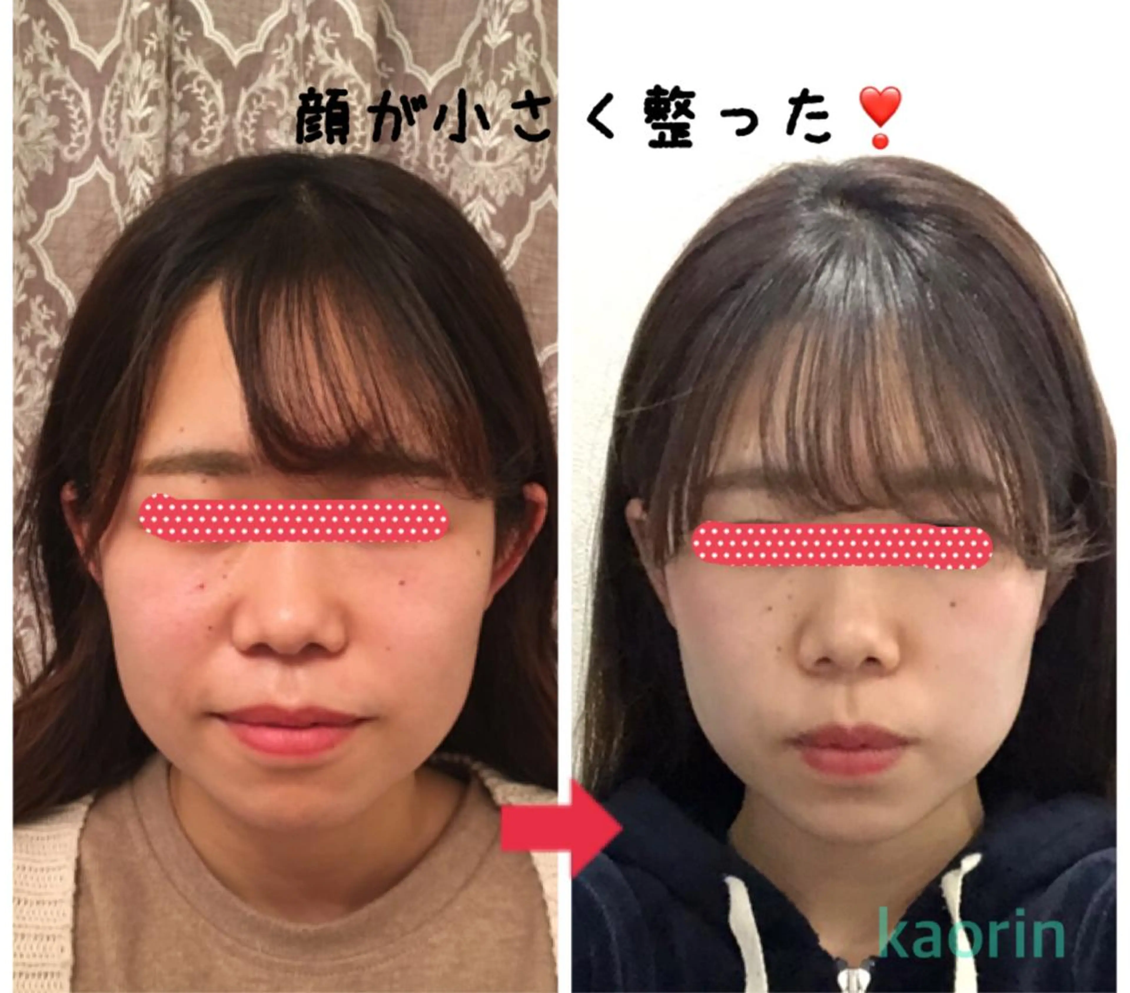 小顔矯正サロン顔凛 KANAのエステ・リラクイメージ