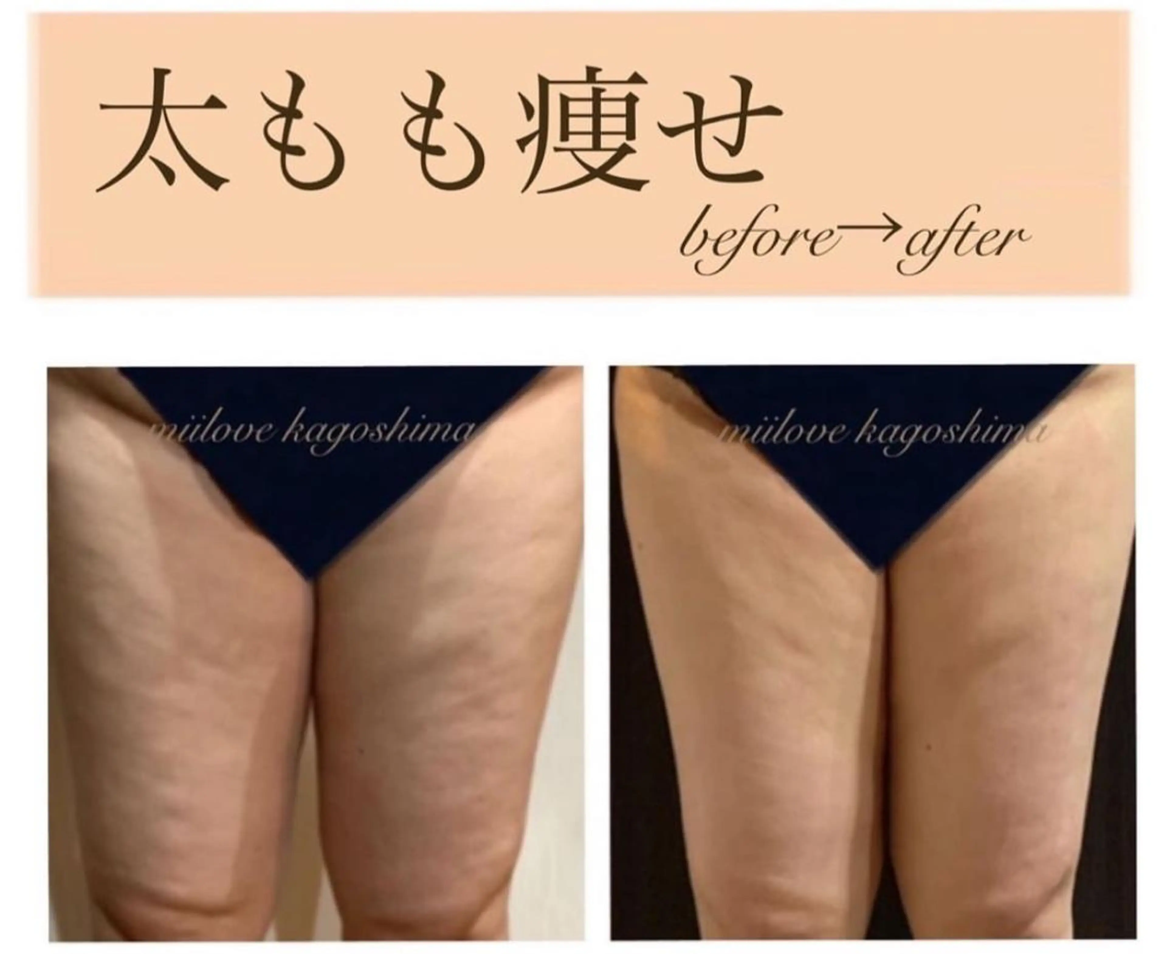 miilove 鹿児島店のエステ・リラクイメージ