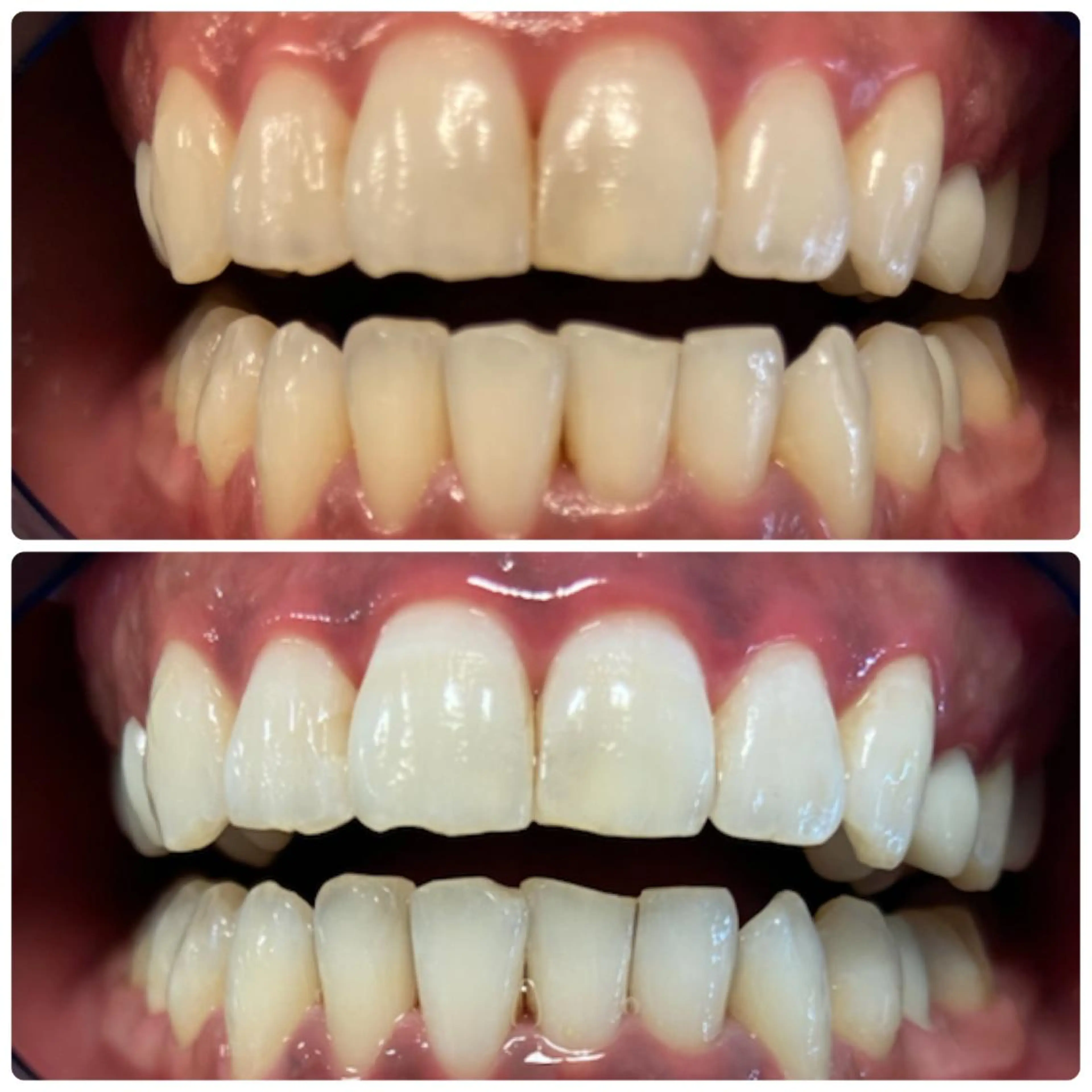 その他 PLATINUM Beauty 横浜店所属・ホワイトニングルーム 横浜店のその他イメージ