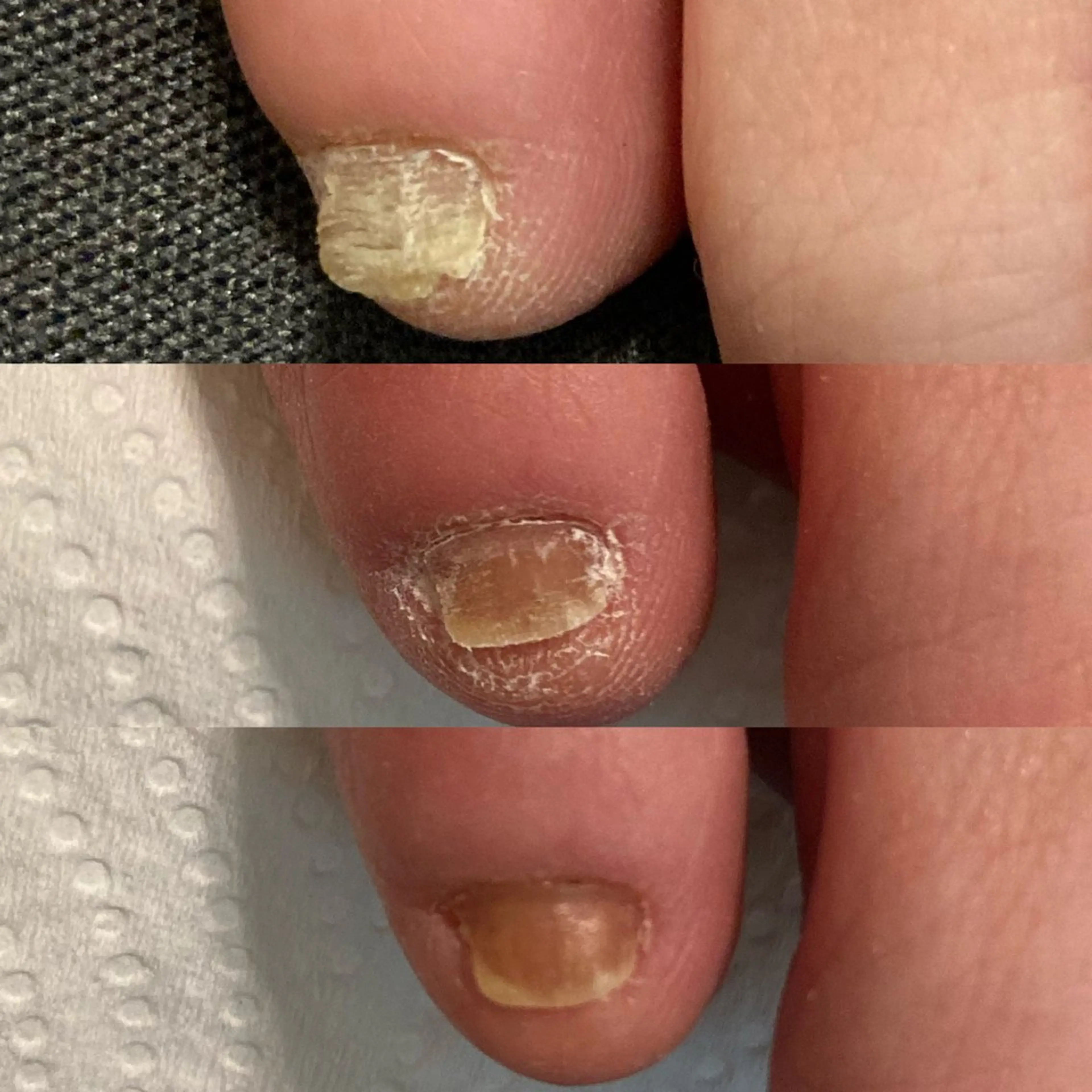 ネイル kanaoa nailのネイルデザイン