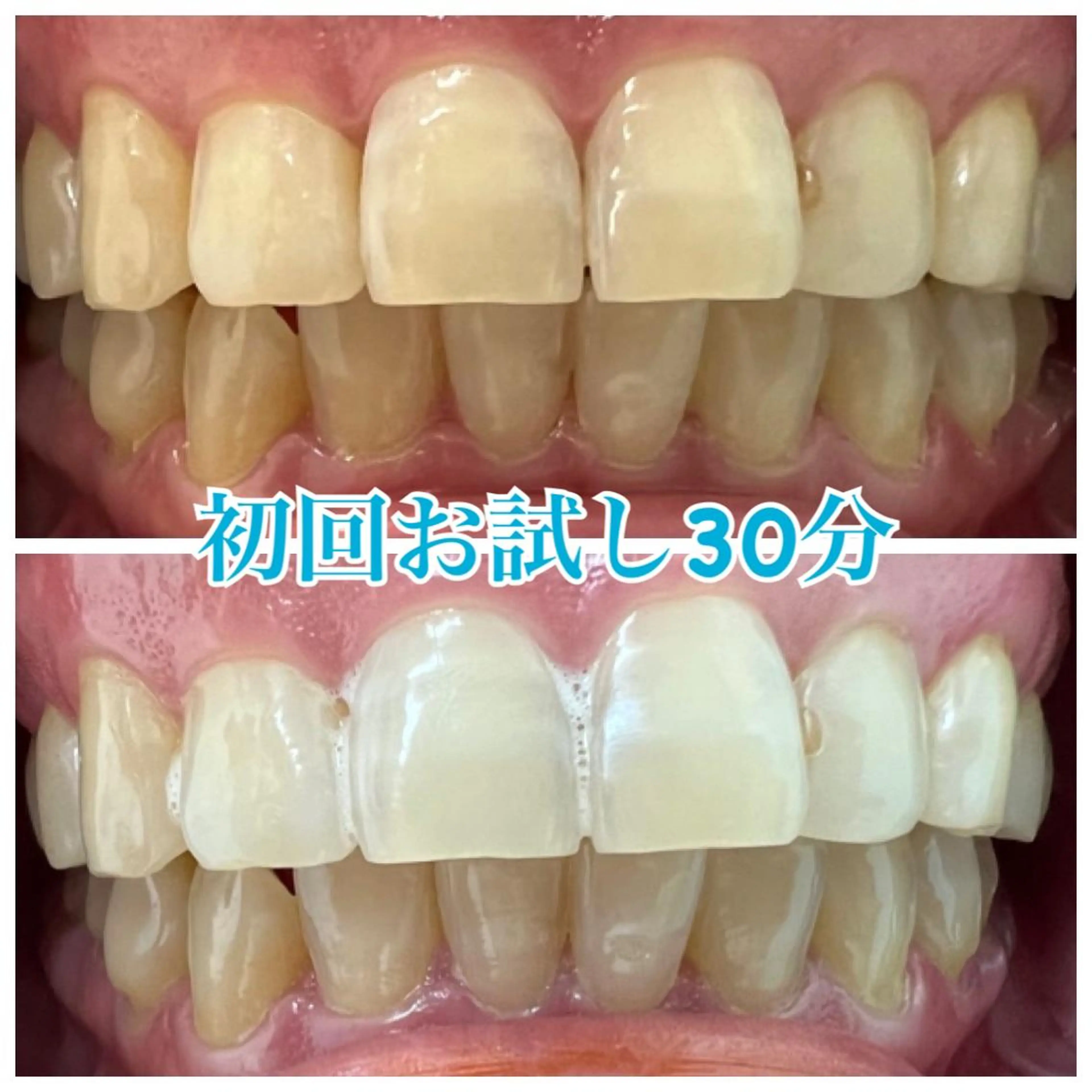 ホワイトニング🦷 ネイル💅LEAのその他イメージ