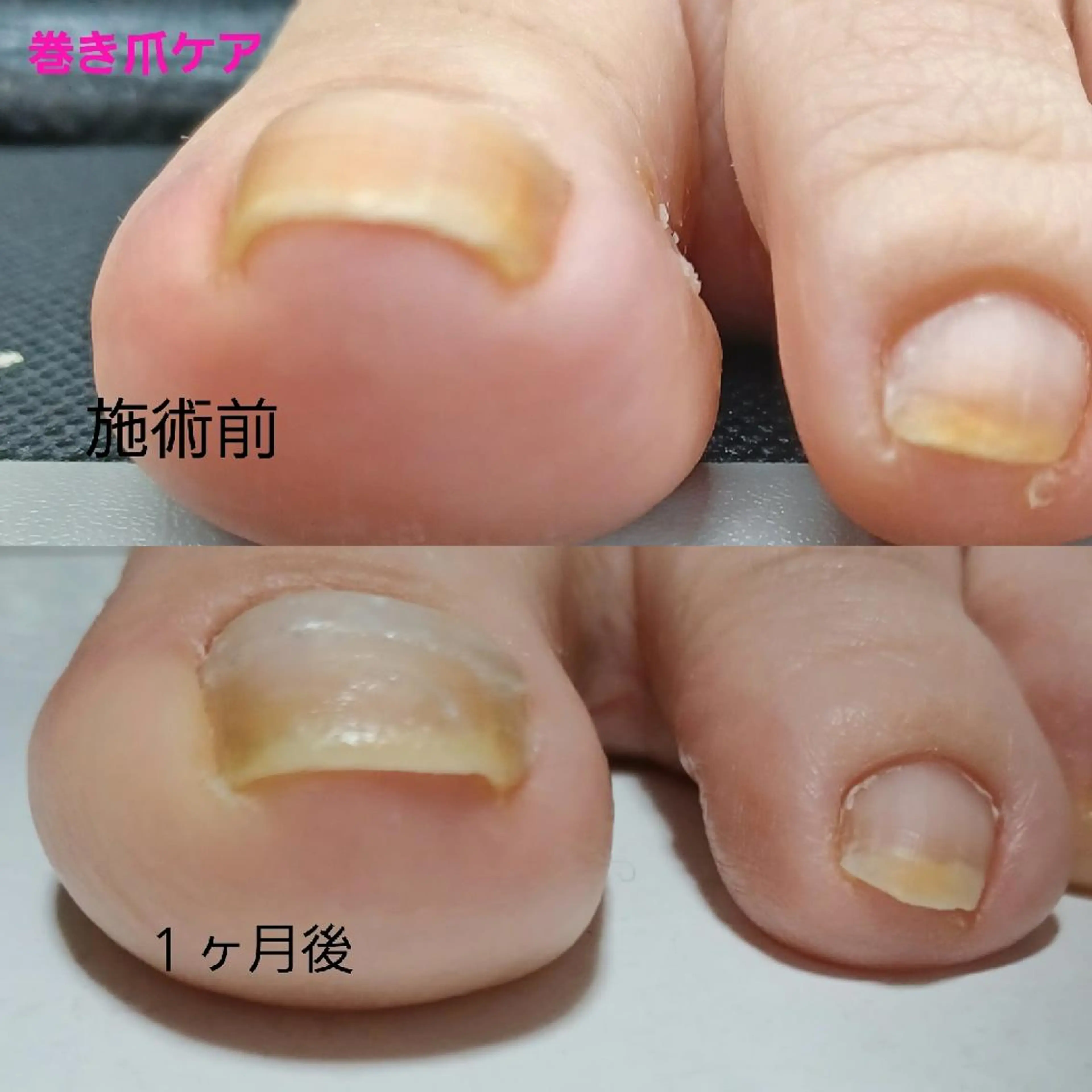 ネイル Micky nail chikushinoのその他イメージ