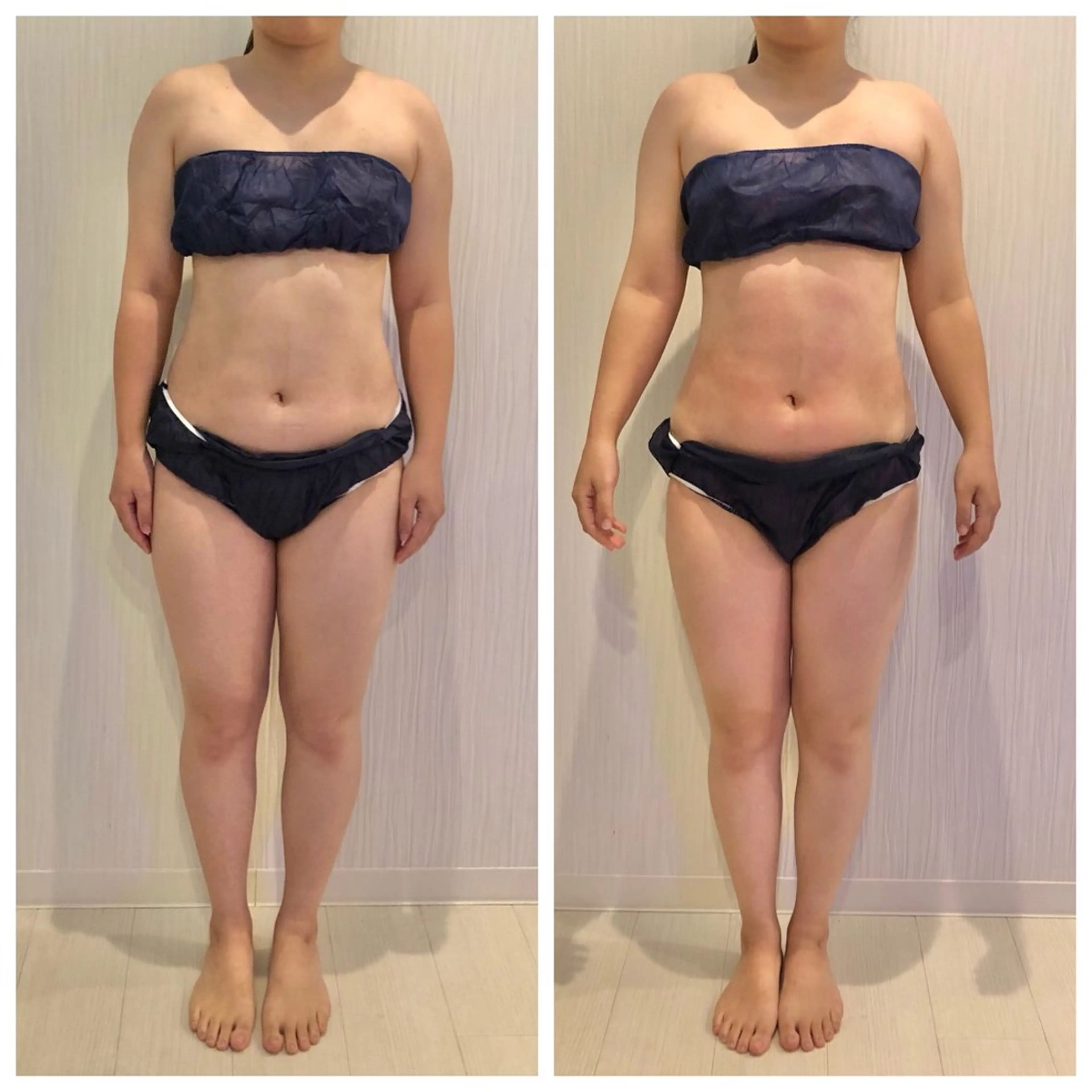 【脳洗浄/痩身】 nature東金のエステ・リラクイメージ