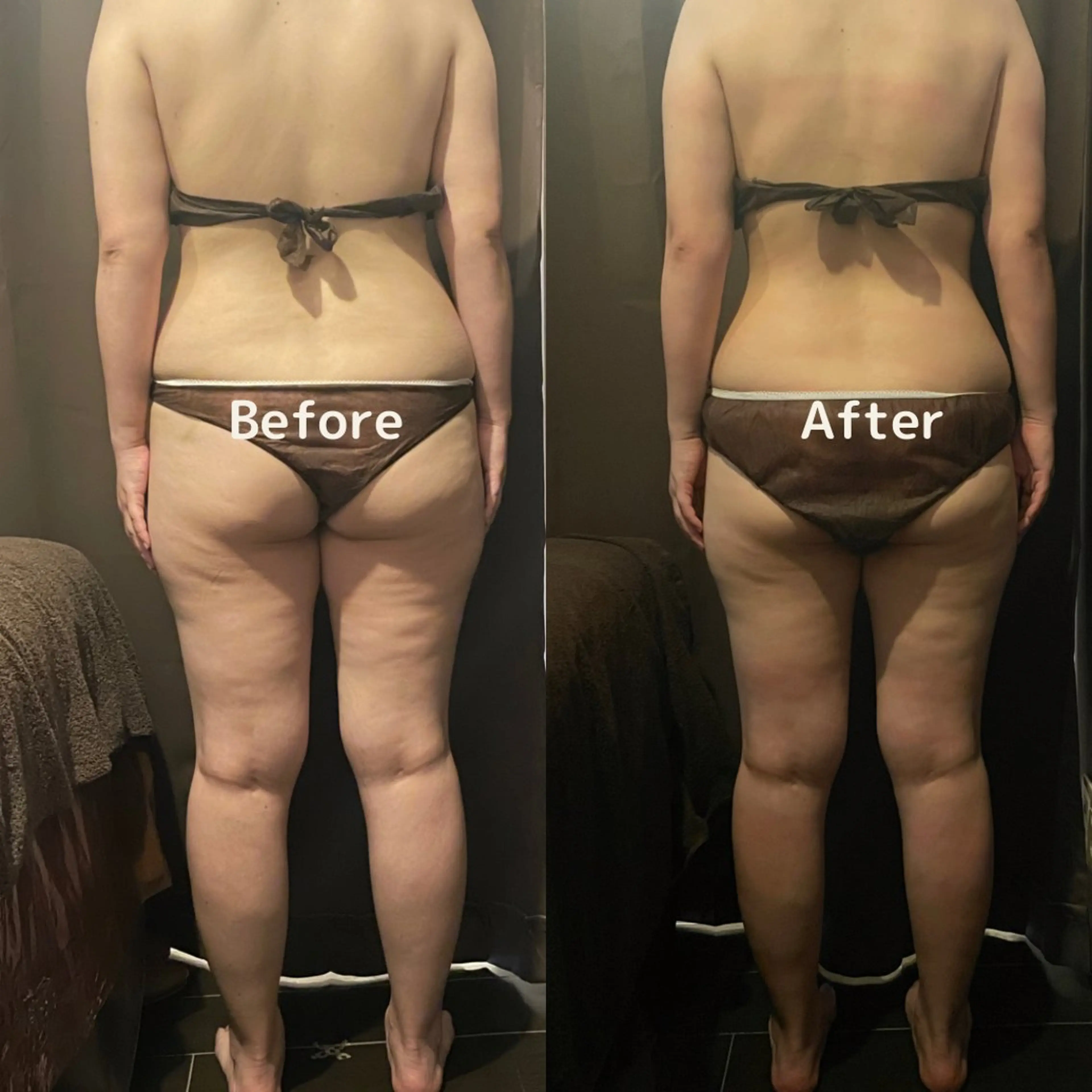 痩身・フェイシャル/if  byOrabriller所属・if byOrab riller【ｲﾌ】のその他イメージ