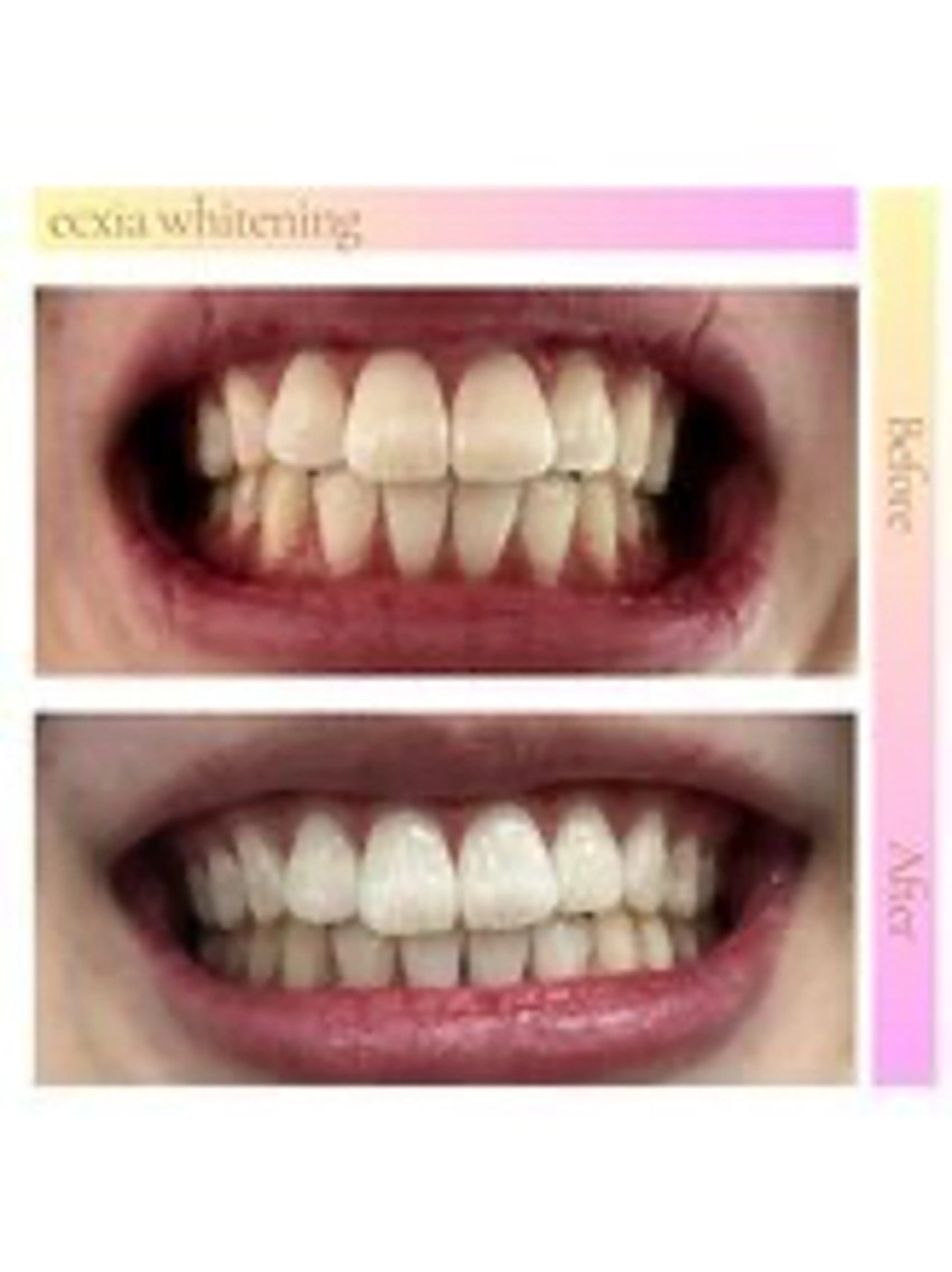 セルフホワイトニング エクシア西宮北口店のその他イメージ