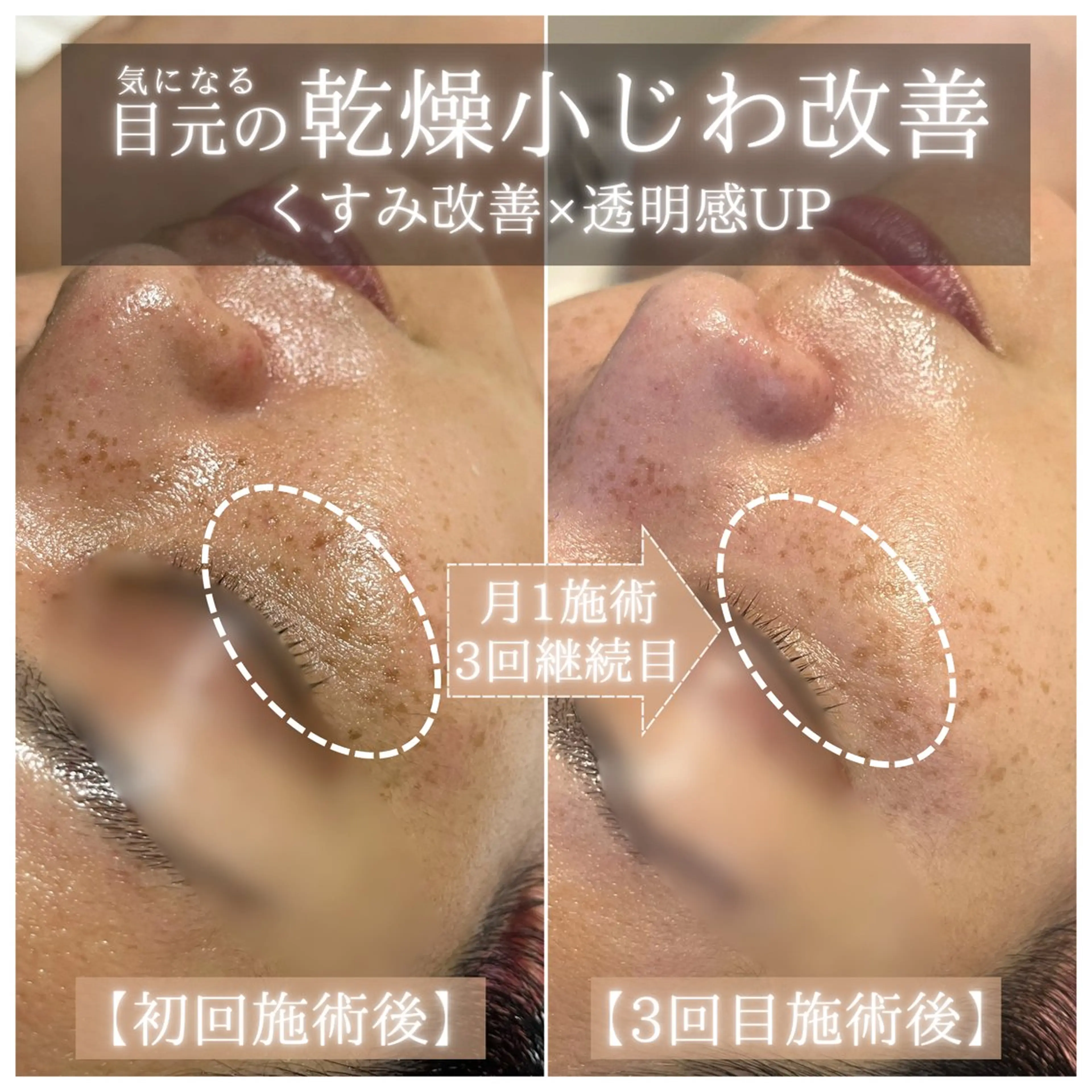 エステ リラク La Dusa 韓国肌管理/小波のエステ・リラクイメージ