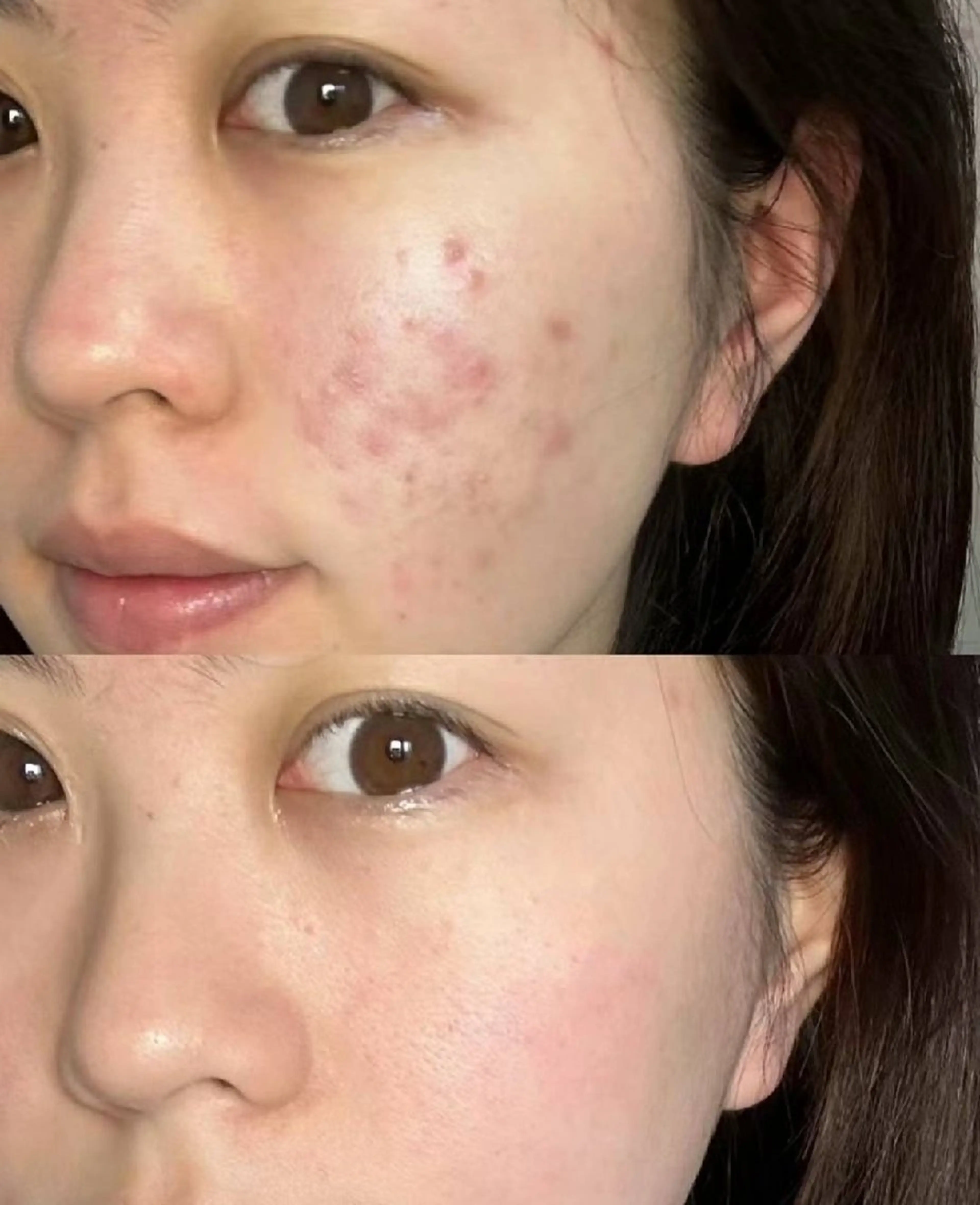 ネイル ブライダルネイル aliaハーブ水光店 エステティシャン募集のエステ・リラクイメージ