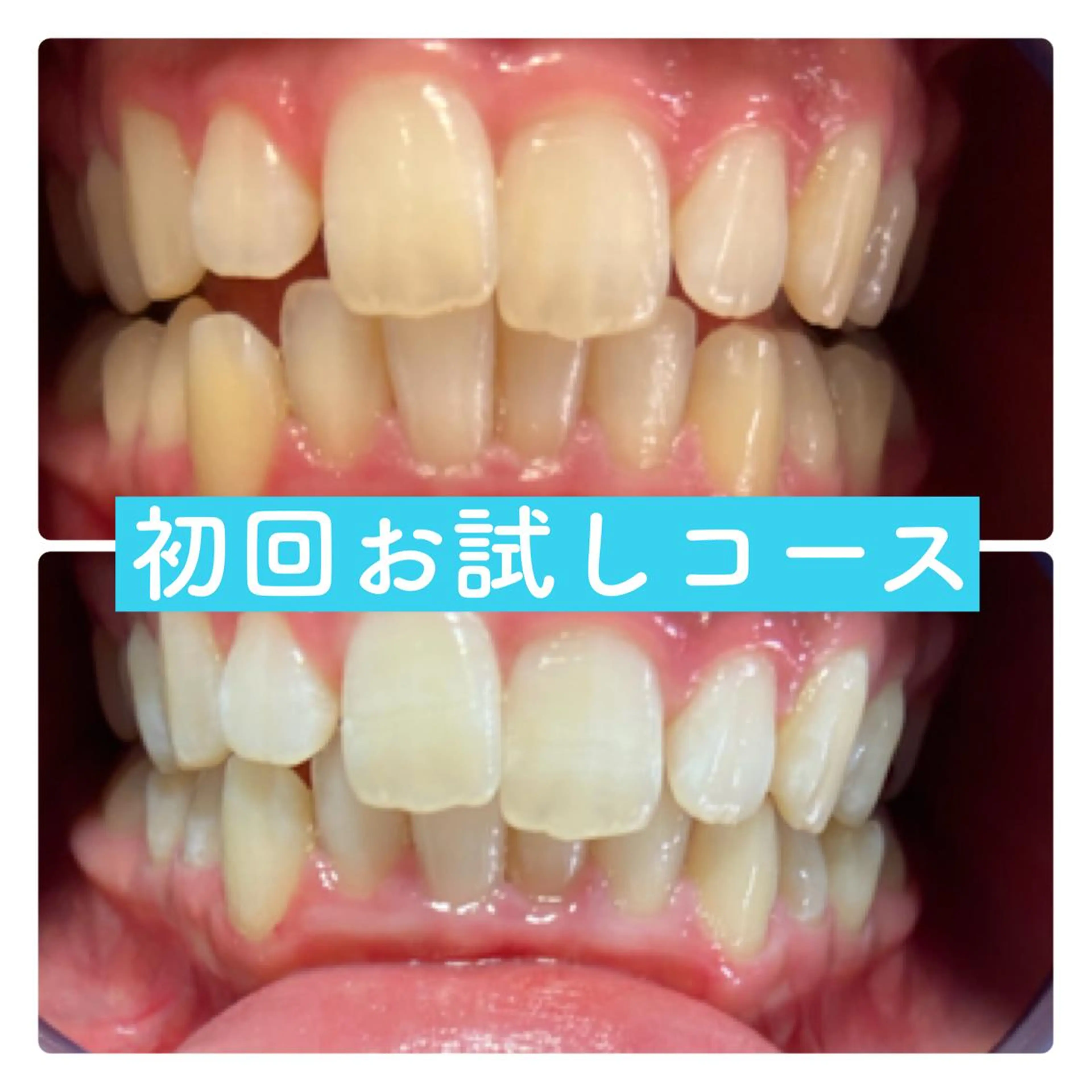 ホワイトニングルーム 横浜店のその他イメージ