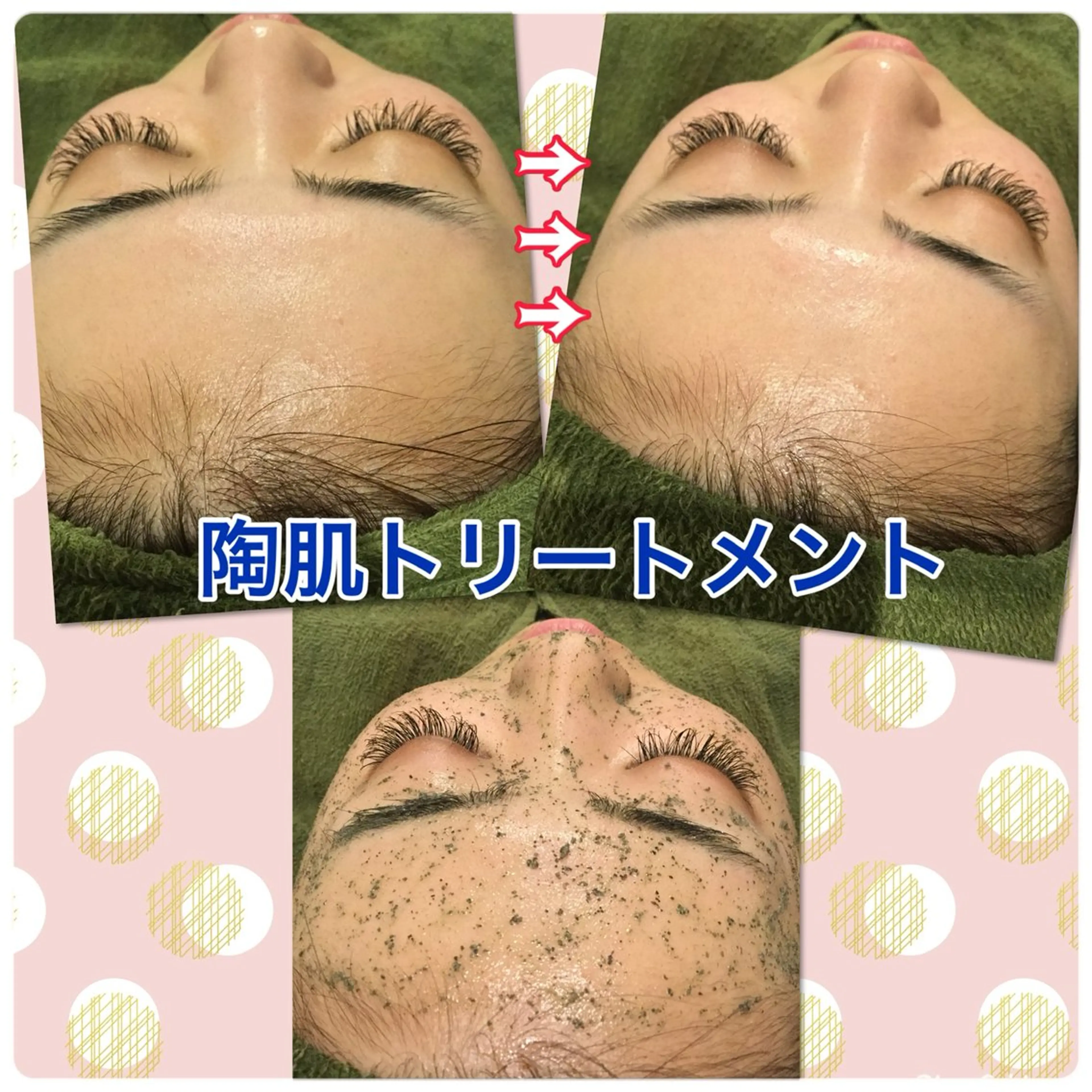 エステ 【リベルハーブピーリング認定店】敏感肌・美白脱毛専門店Dione立川店所属・Dione 立川店のエステ・リラクイメージ