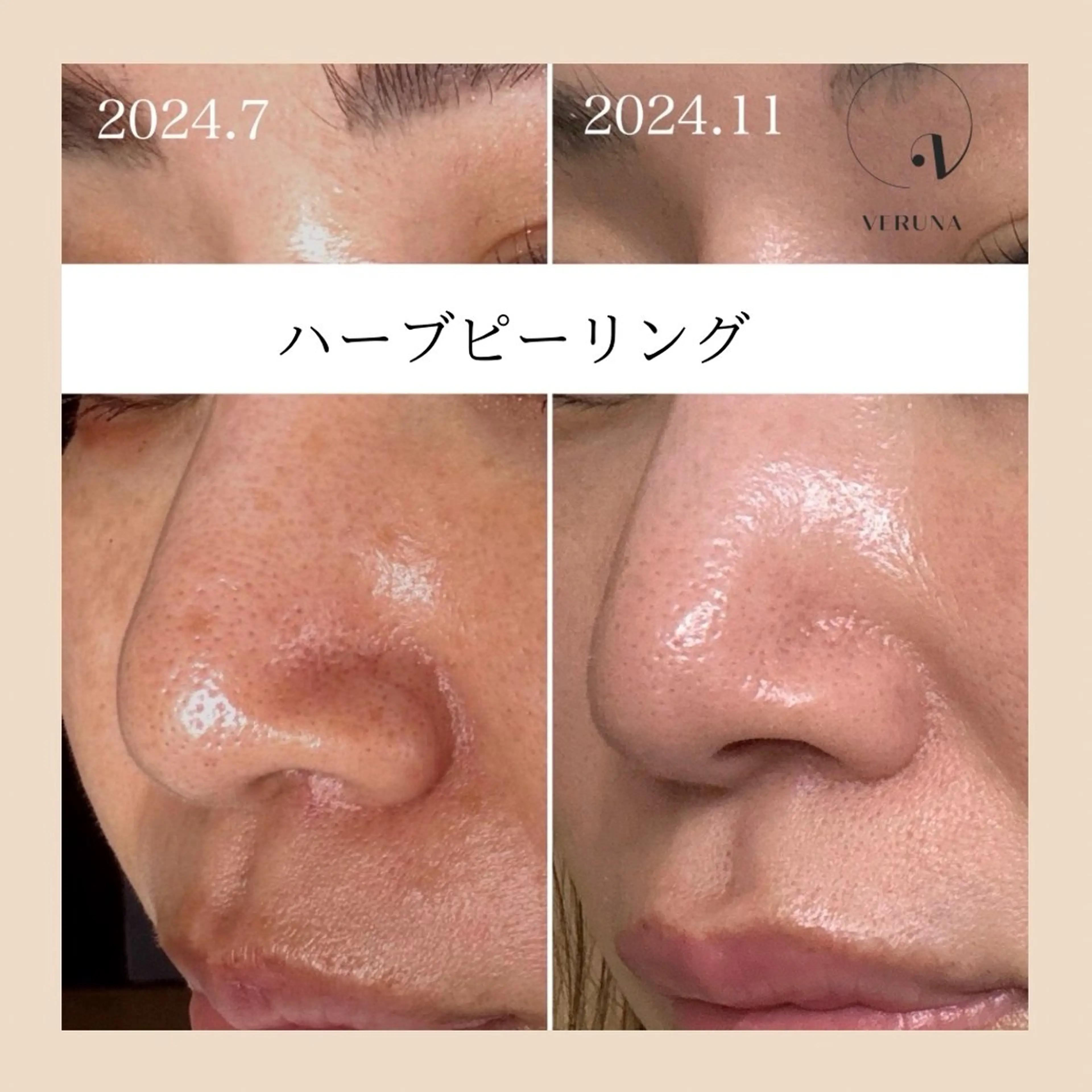 エステ リラク ピーリング専門店 Belluteのエステ・リラクイメージ