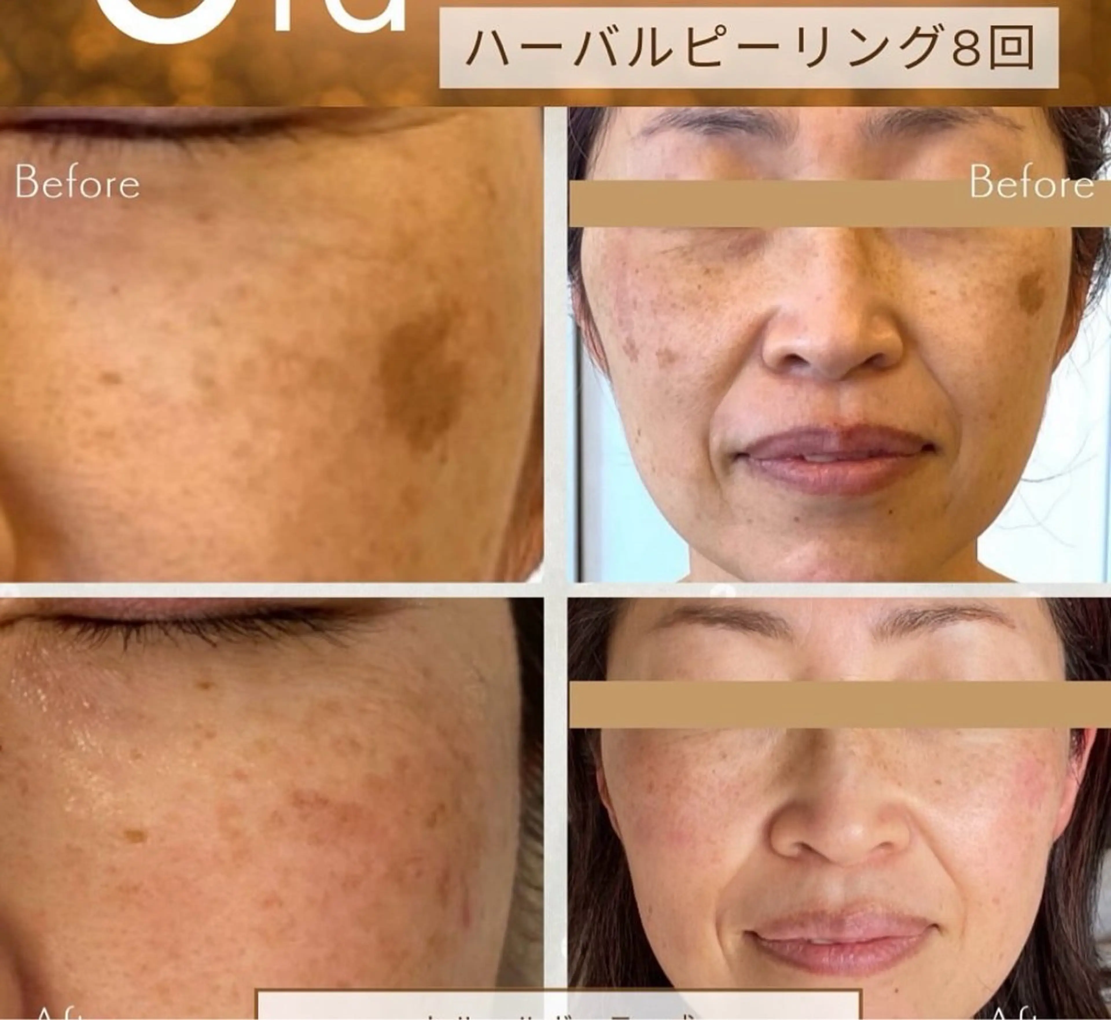 冨菜 みらいのエステ・リラクイメージ