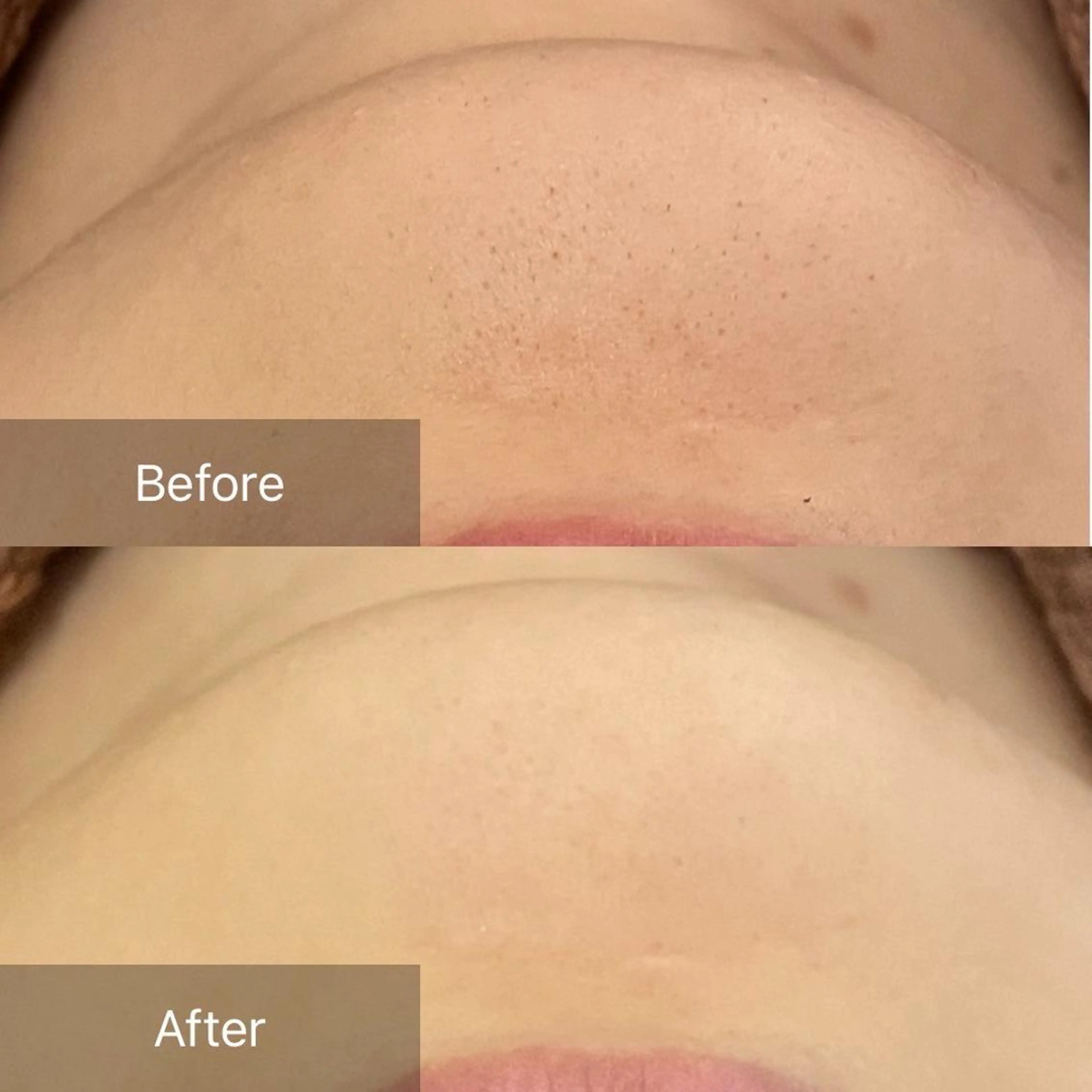 エステ 毛穴/毛穴洗浄専門 エミルカ船橋のエステ・リラクイメージ